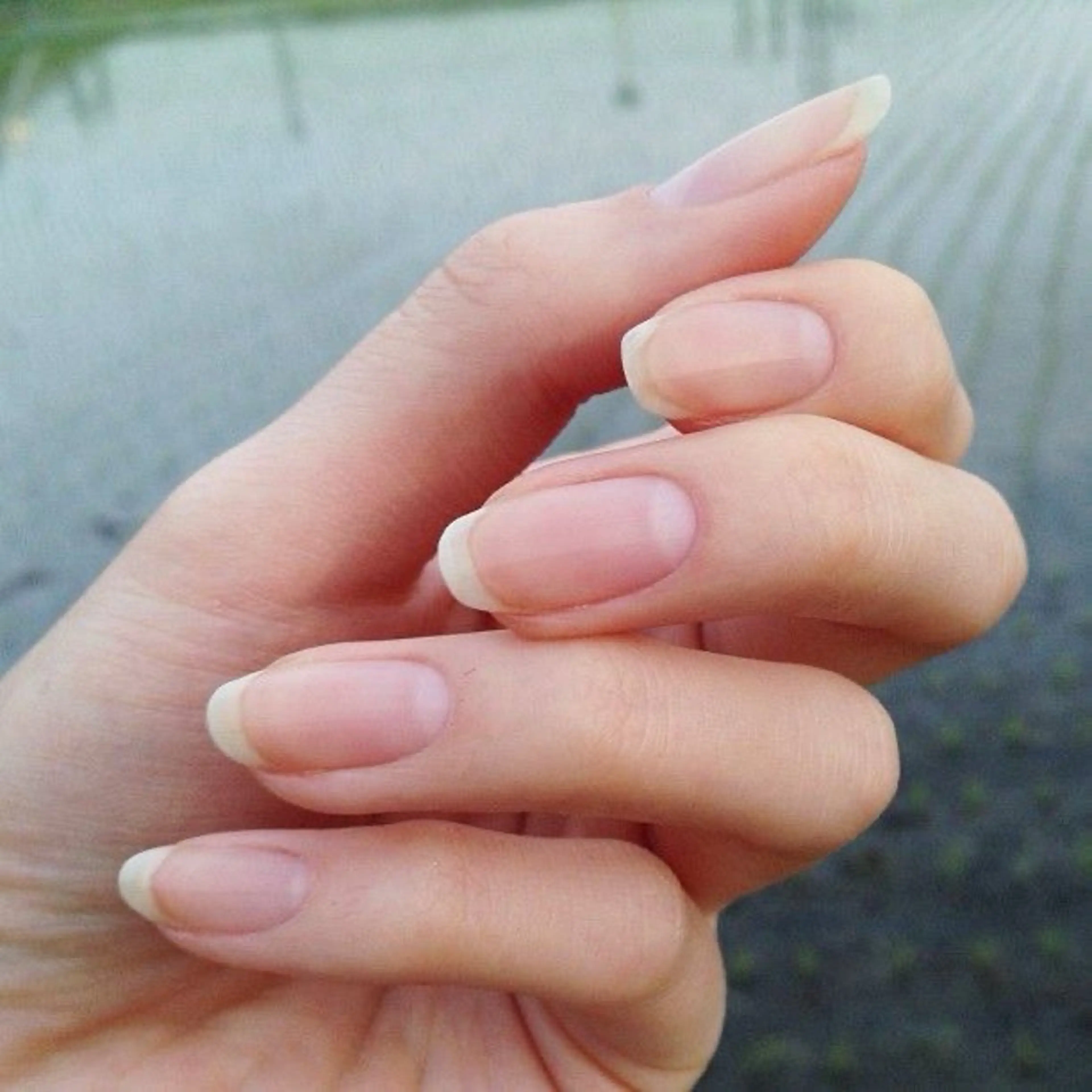【Hand】自爪戻しの写真