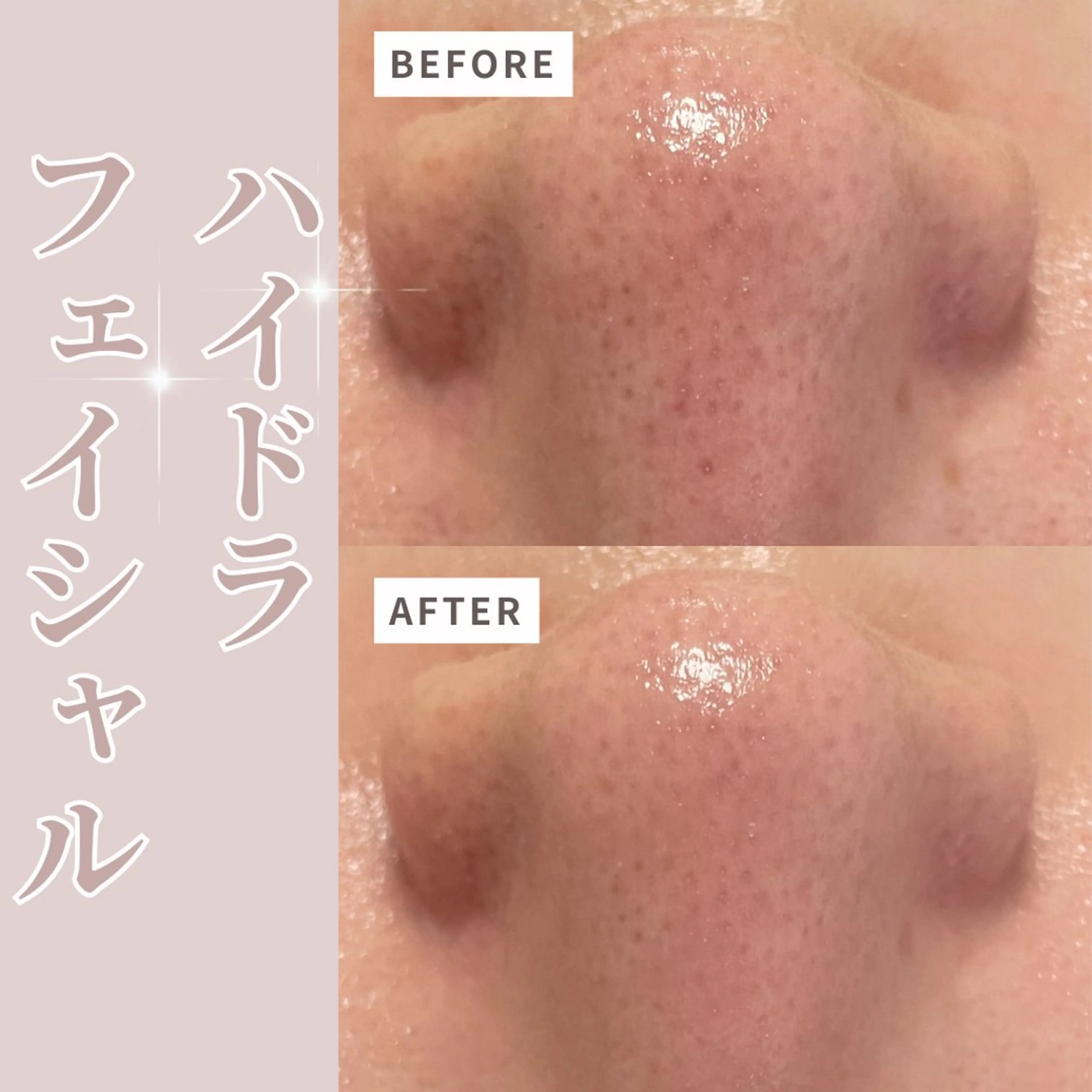 エステ リラク プライベートサロン Belle（ベル）のエステ・リラクイメージ