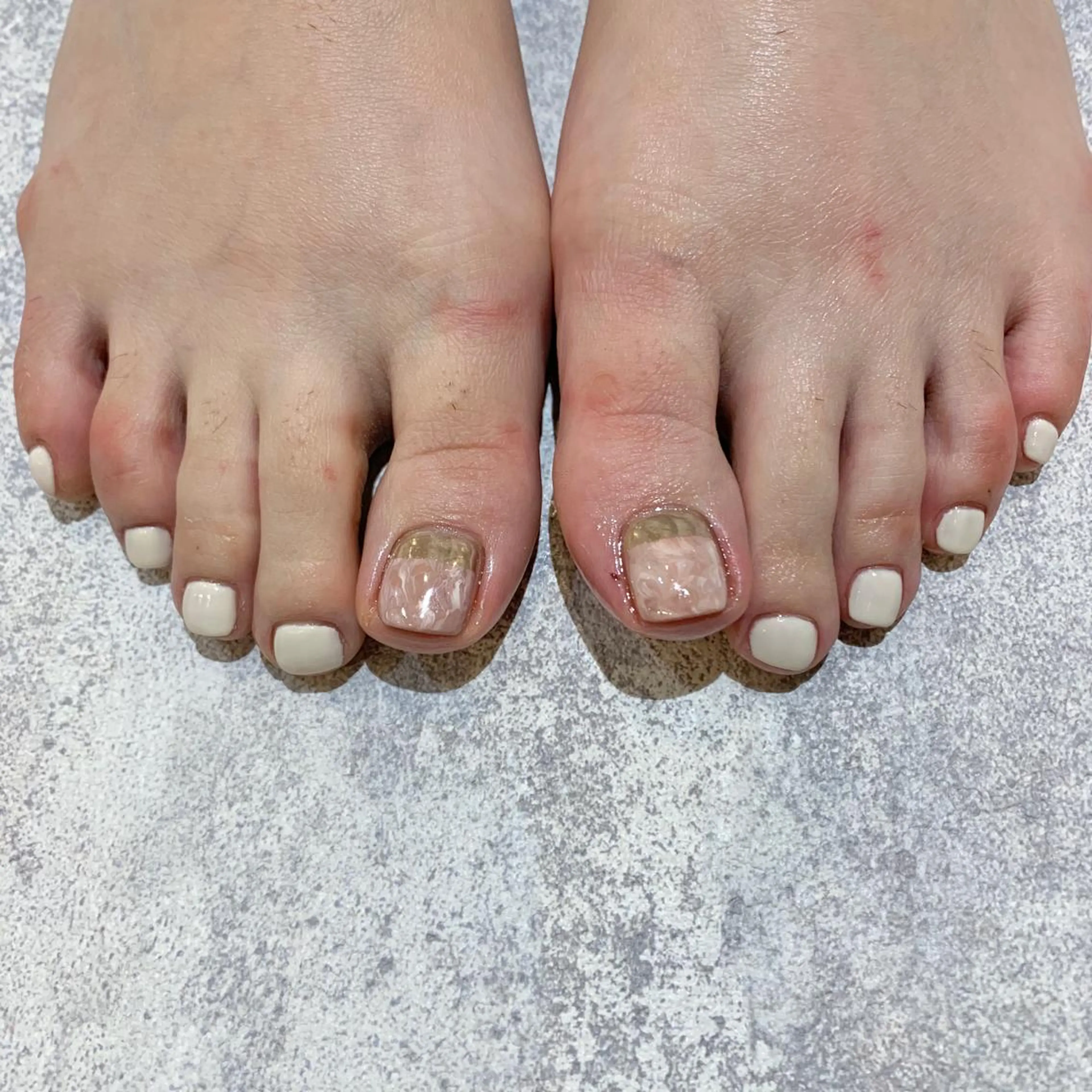 ネイル フットネイル nail slon mioのネイルデザイン