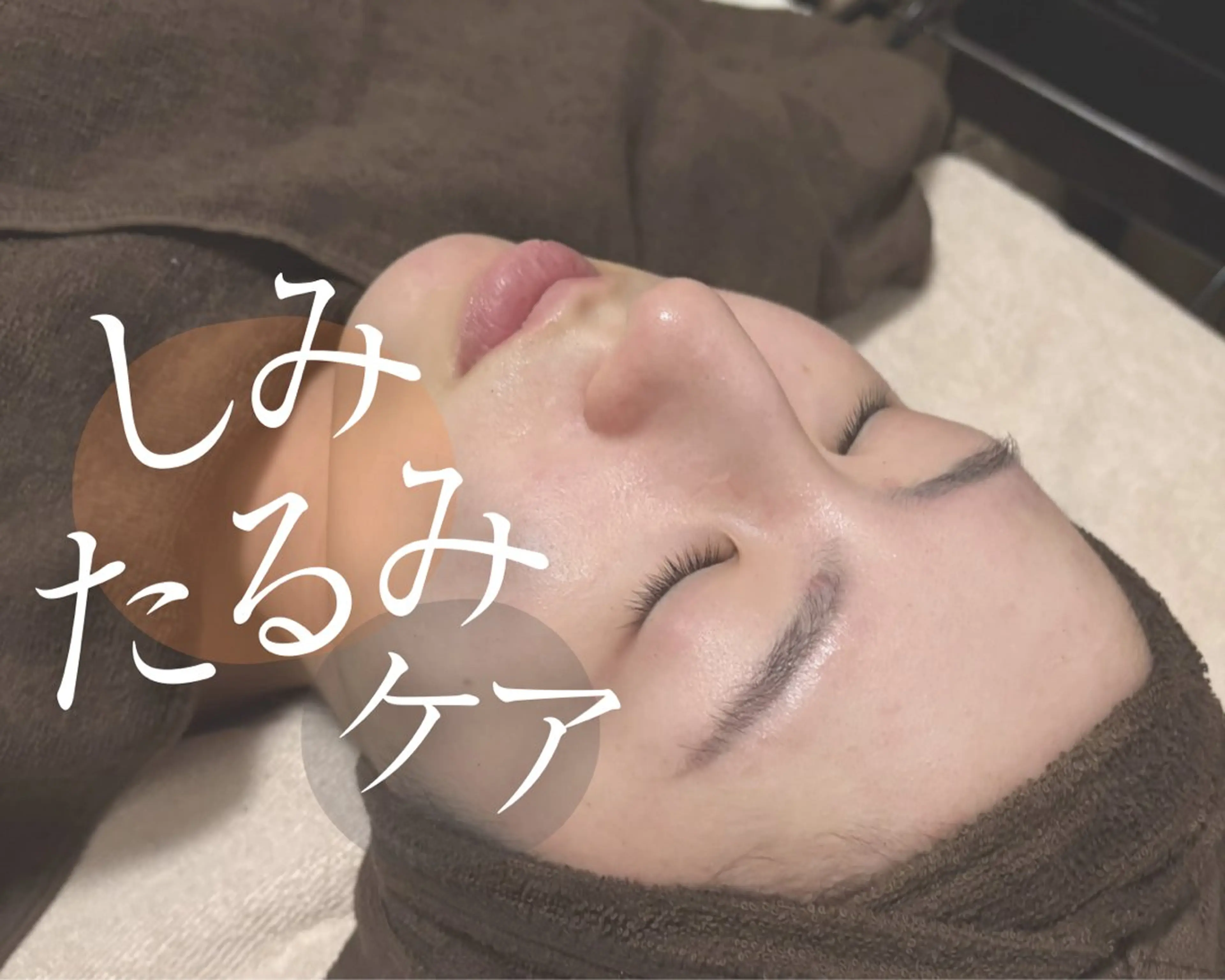 シミ・たるみケア！くすみケア+ﾋﾞﾀﾐﾝC導入+筋膜EMS(注意事項ご確認ください)の写真