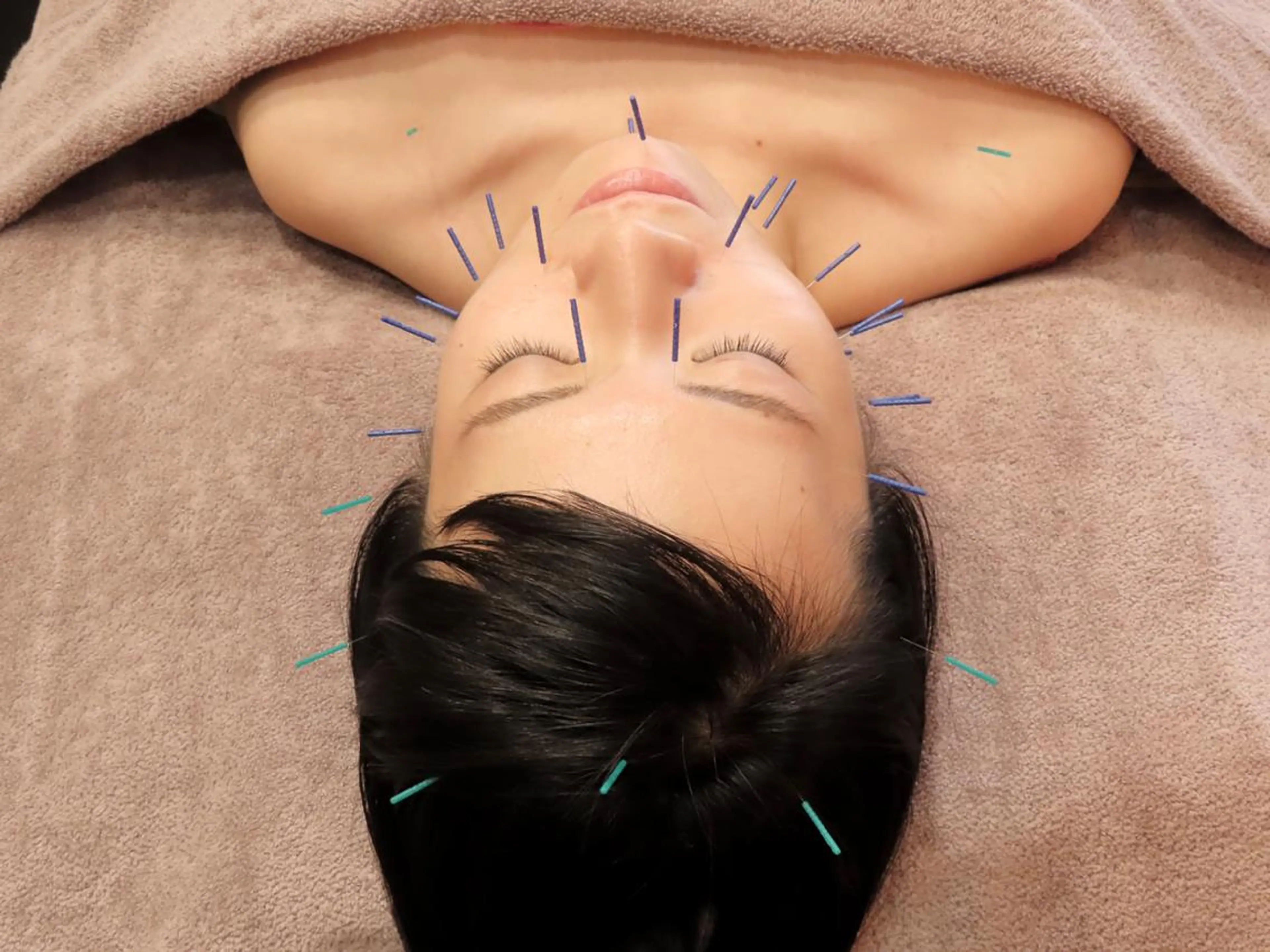 麻布十番/圧倒的小顔 🐷毒だし美容鍼灸のエステ・リラクイメージ