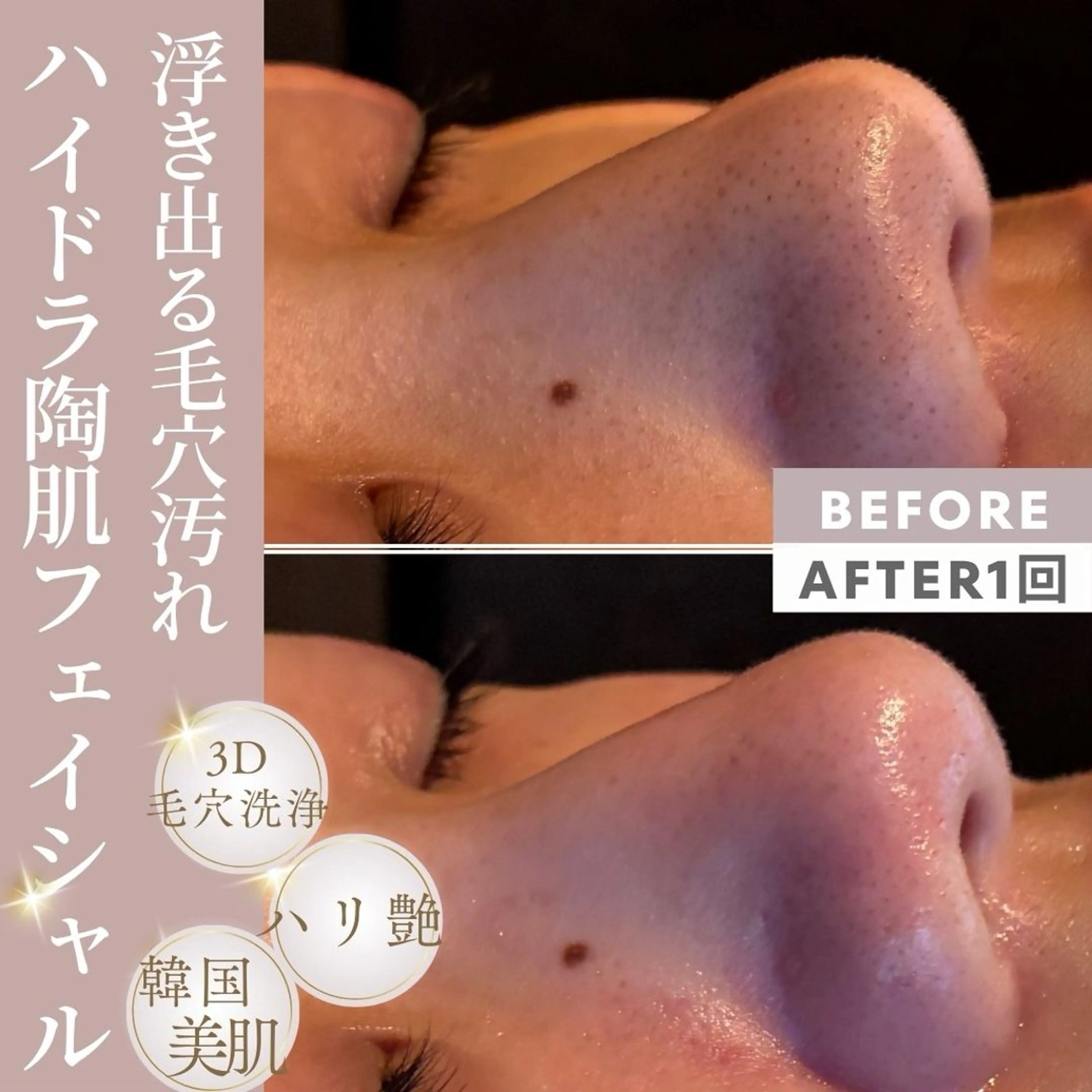🆕２回目以降の方☺️黒ずみ毛穴が気になる方へ🌺【毛穴洗浄&引き締めフェイシャル】【メンズも大歓迎⭕️】の写真