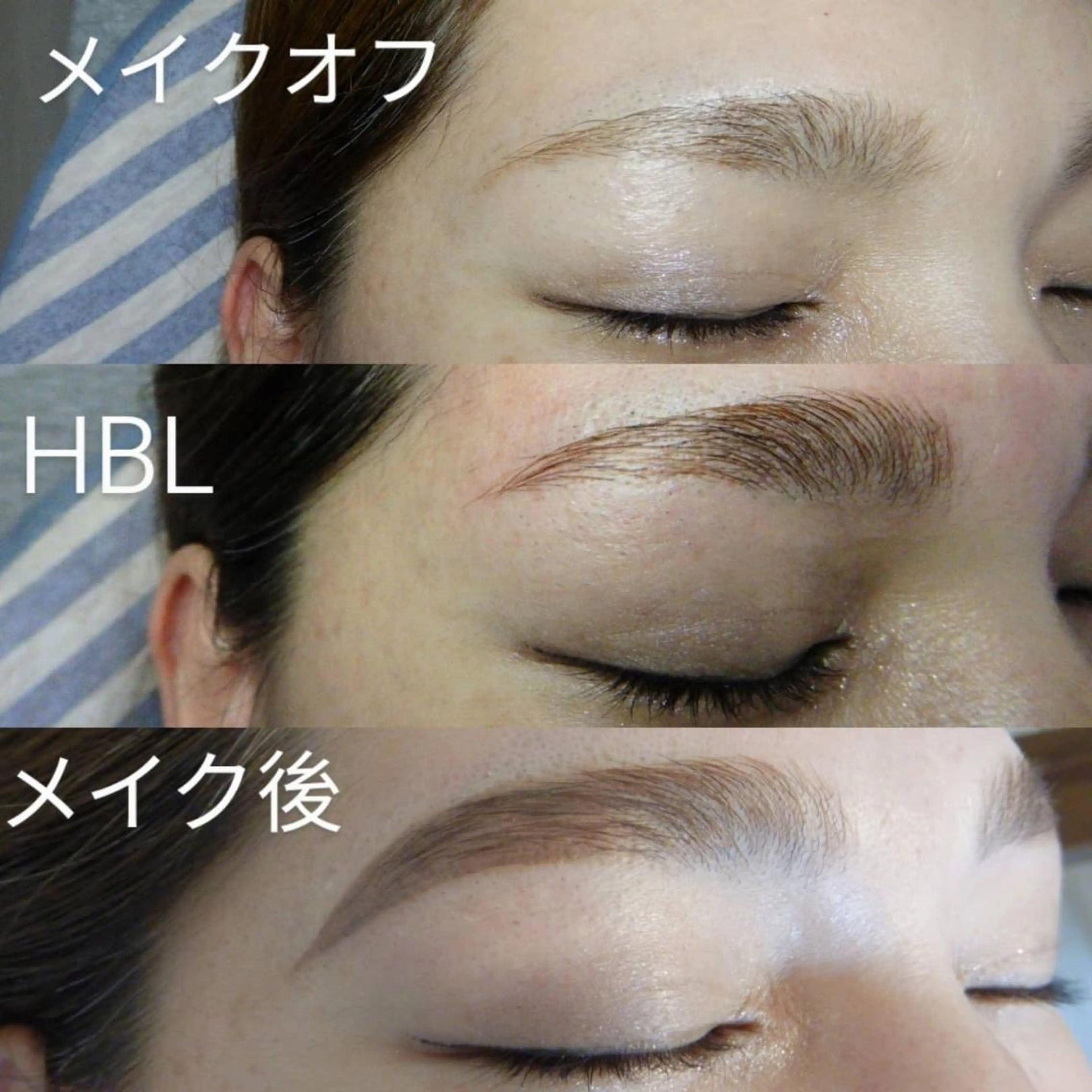 3回目から⇒ハリウッドブロウリフト(HBL) 施術時間90分  7,500 円の写真