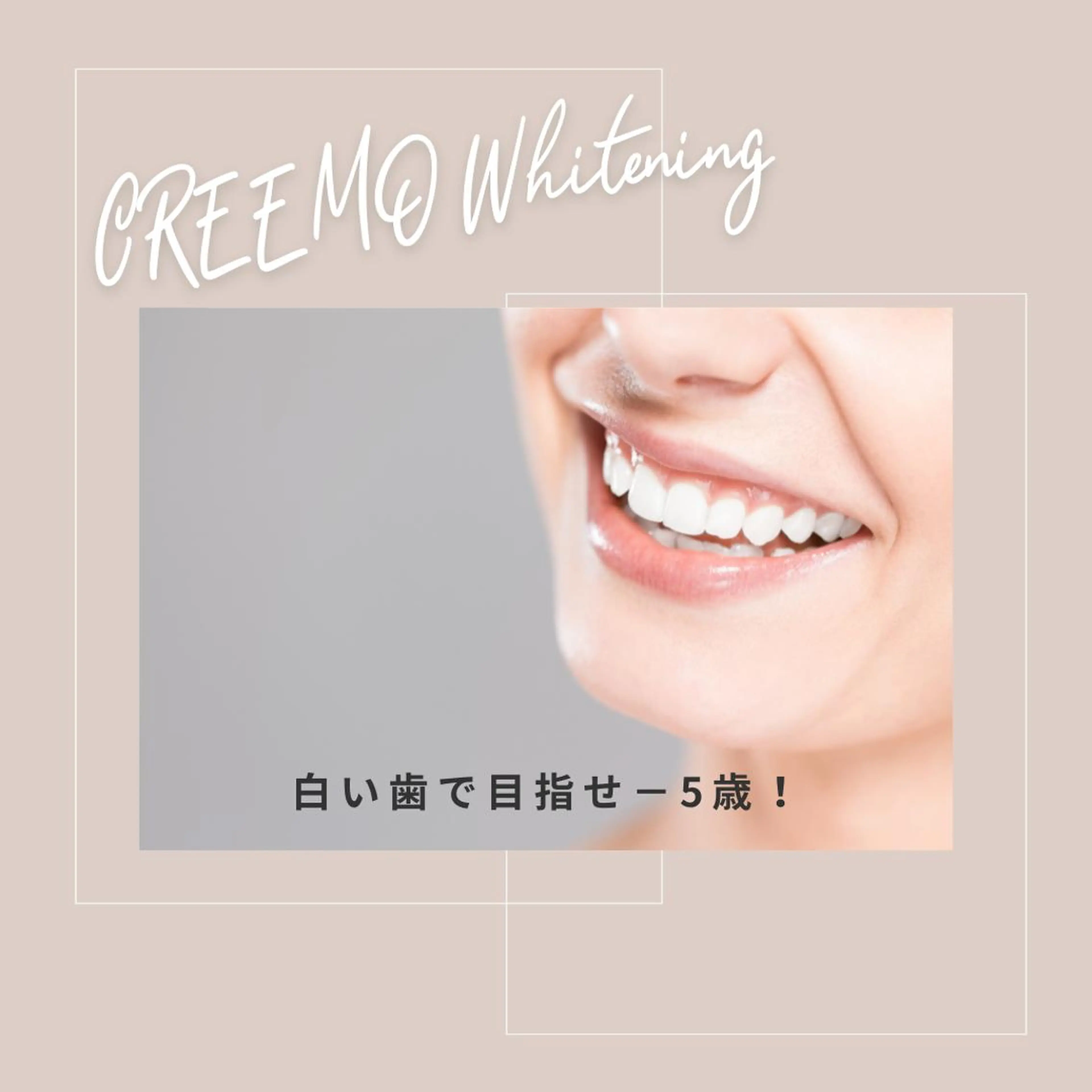 歯のホワイトニング CREEMO南浦和のその他イメージ
