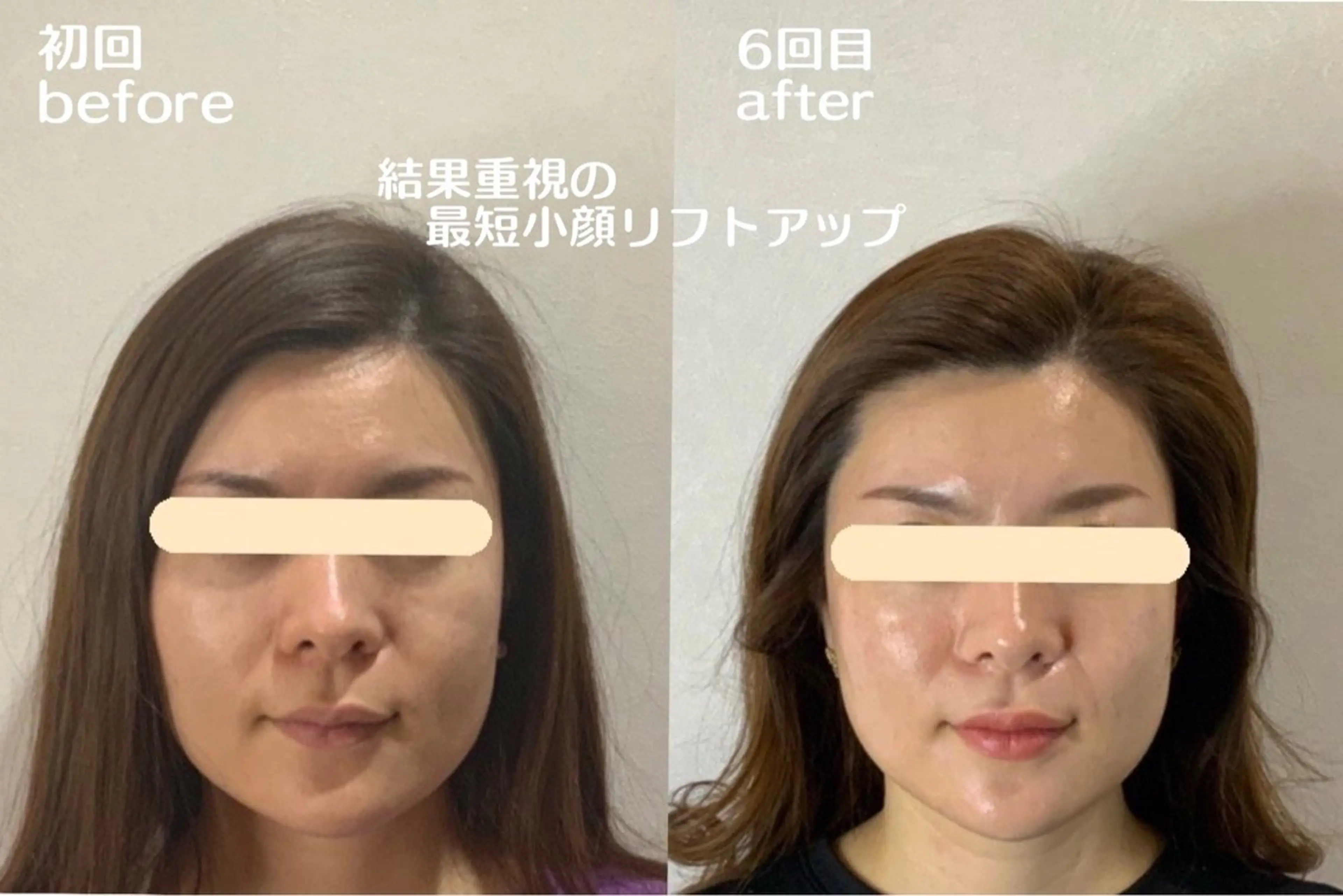 小顔・肌質改善 espoir 心斎橋のエステ・リラクイメージ