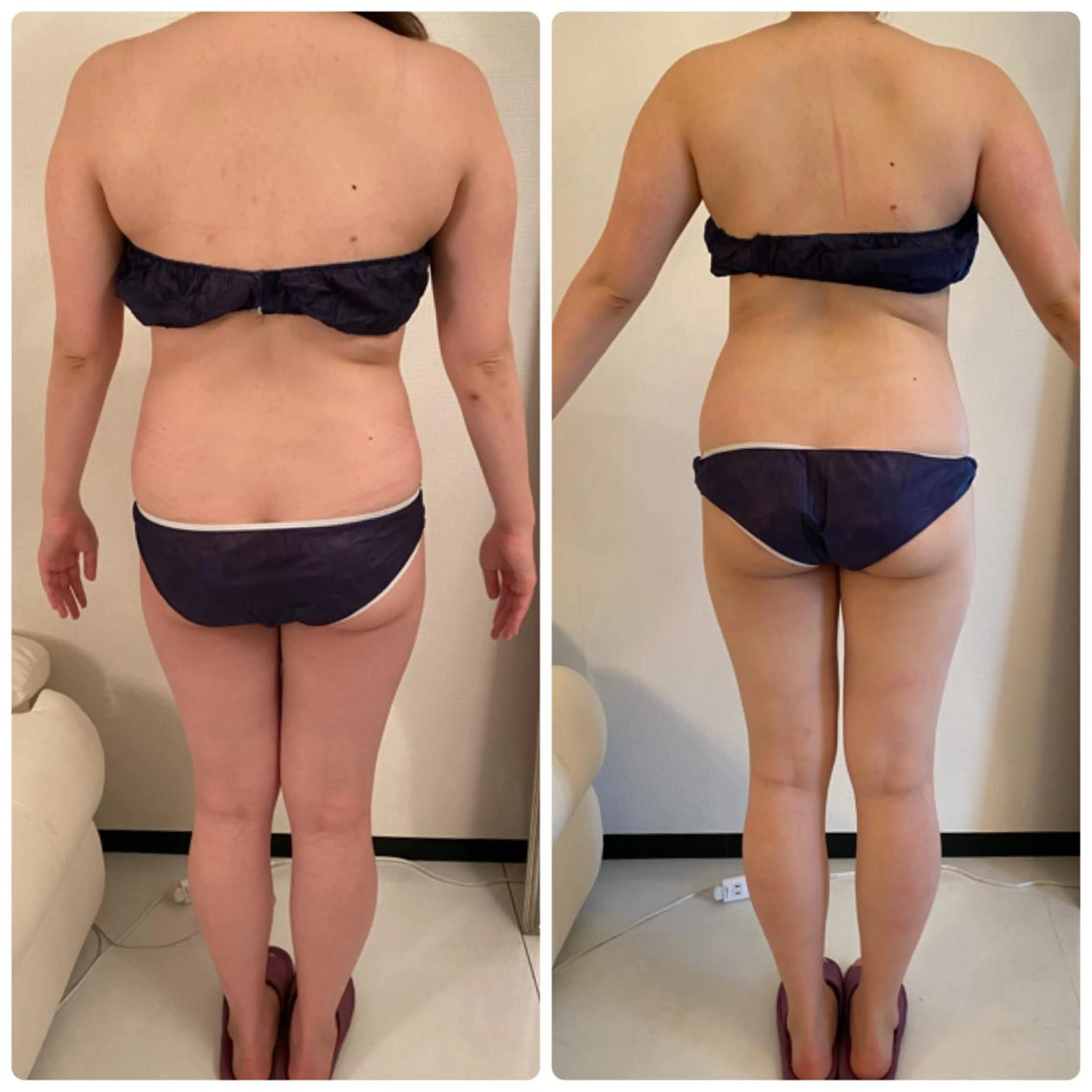 FLEUR大阪・整体 ・ハイフ・痩身・小顔のエステ・リラクイメージ