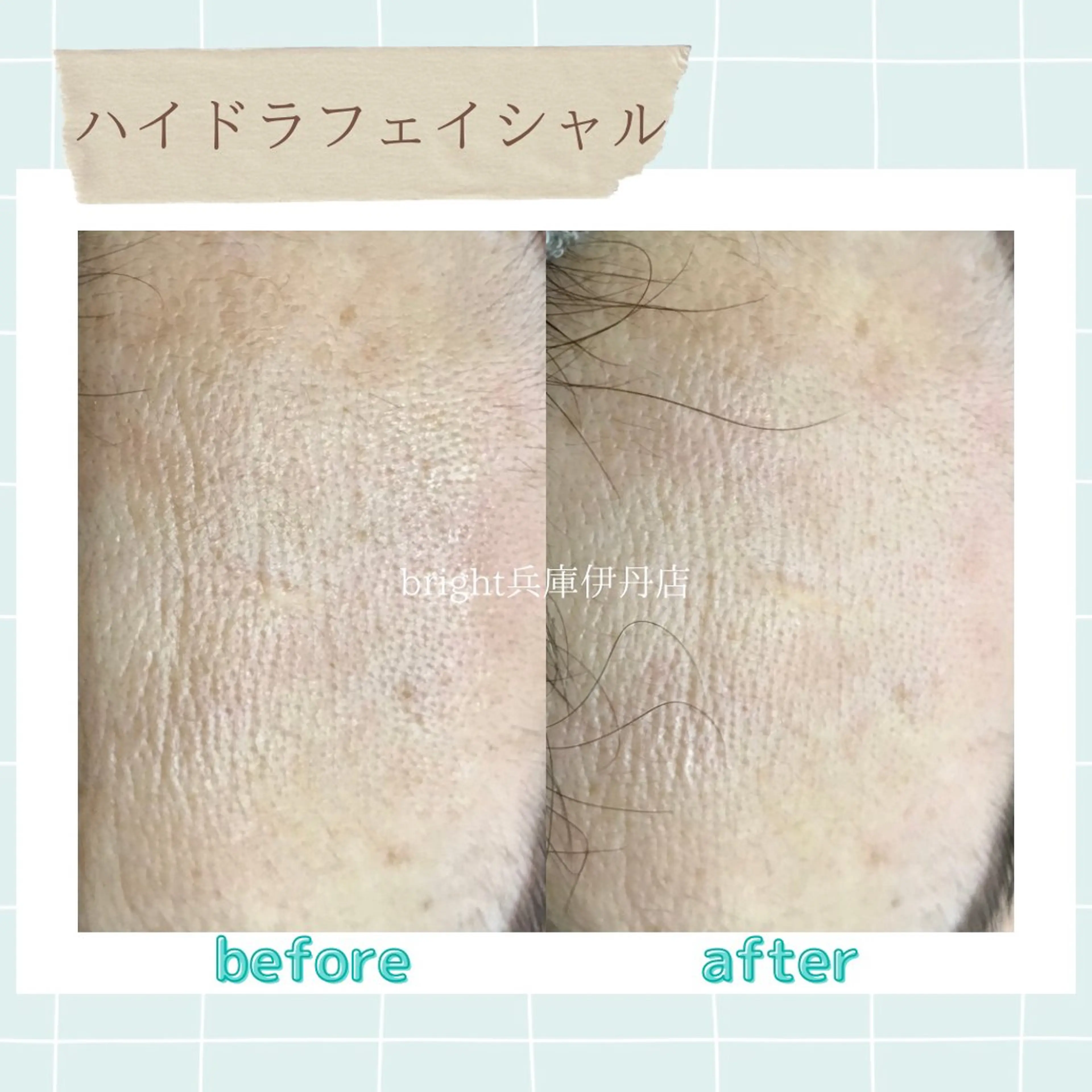 メンズ お手軽ホワイトニングsalon mina所属・武元 奈津美のエステ・リラクイメージ