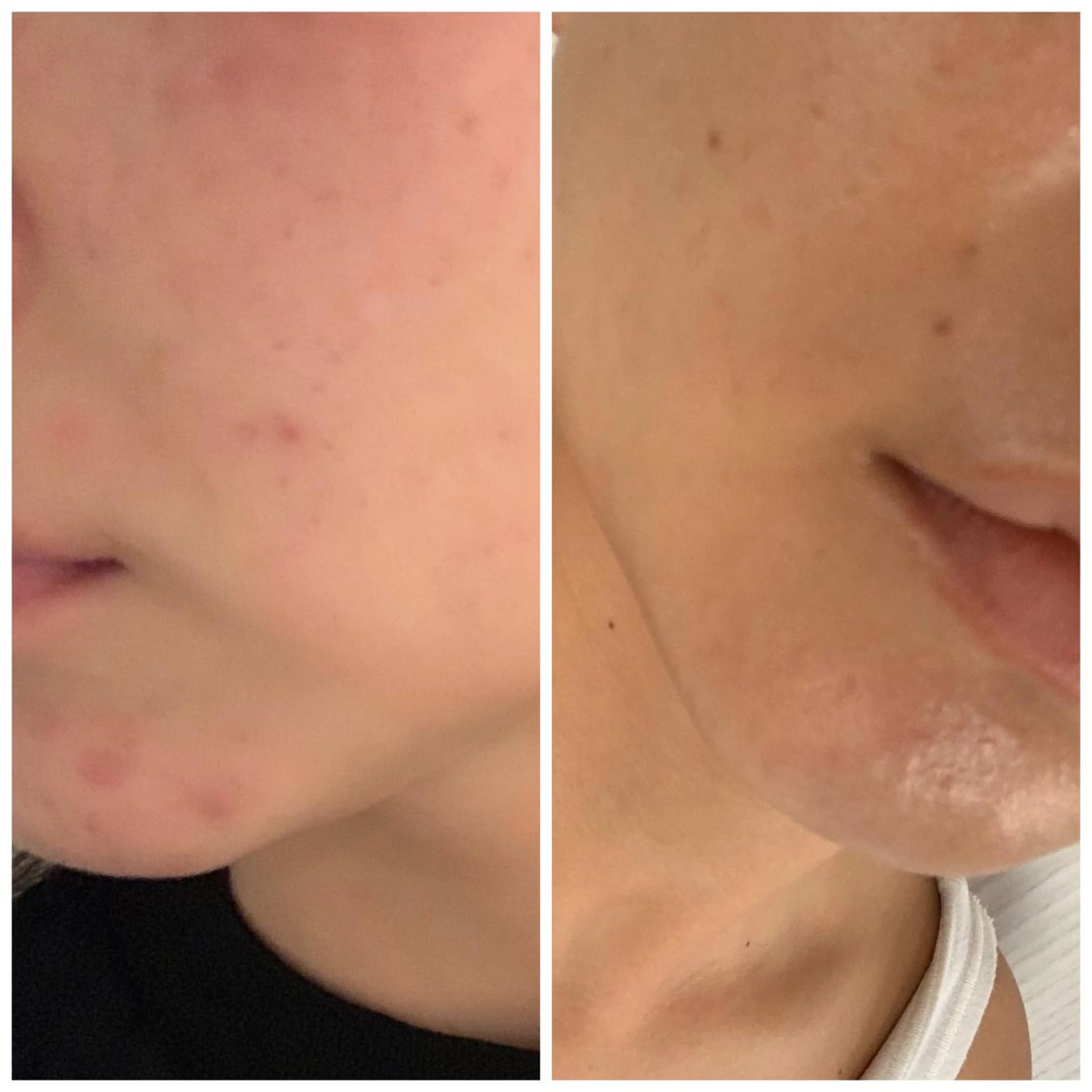 食べながら魅せボディ éclatJua川越のエステ・リラクイメージ