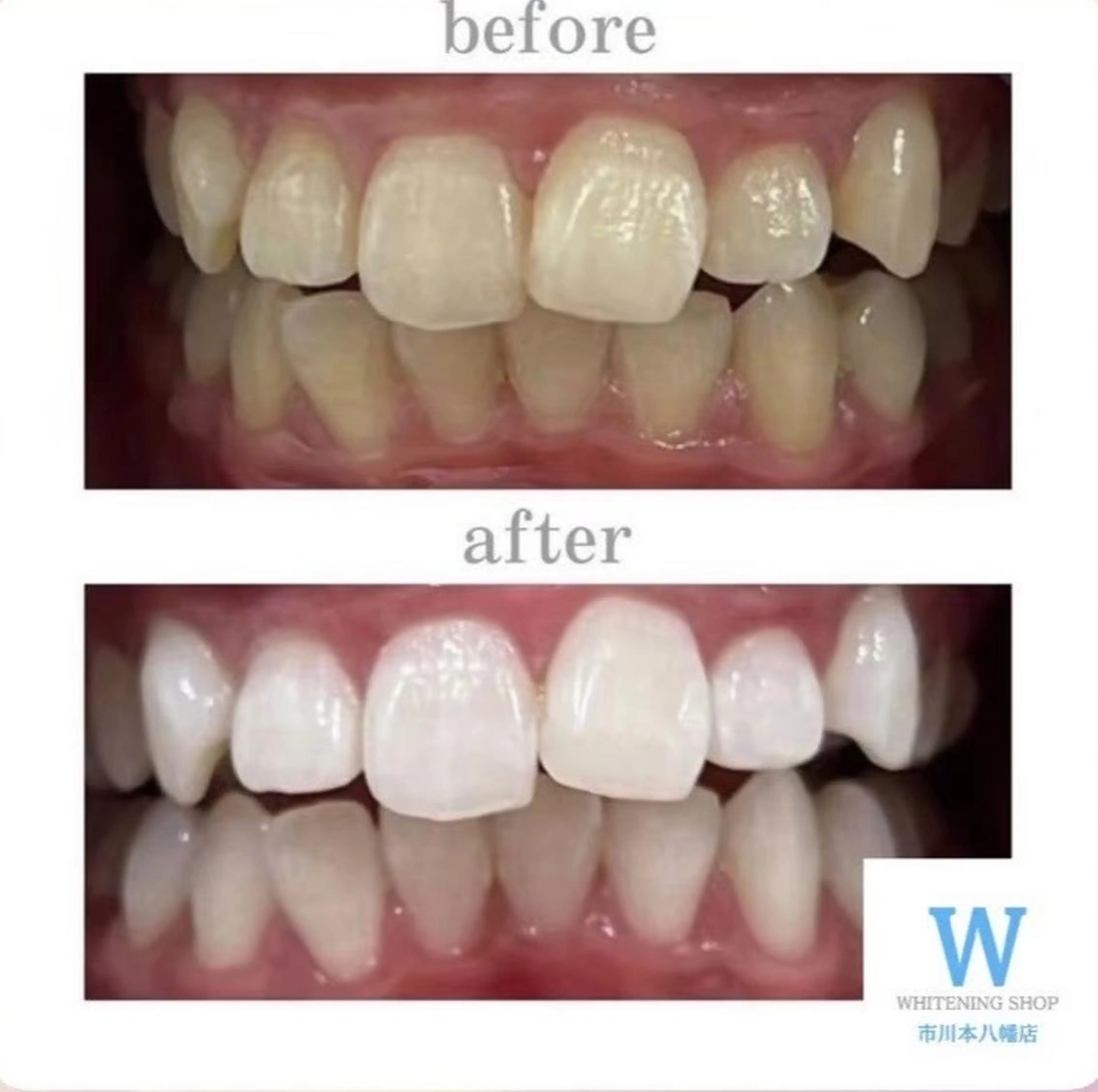 エステ リラク ホワイトニング ショップ本八幡店のエステ・リラクイメージ