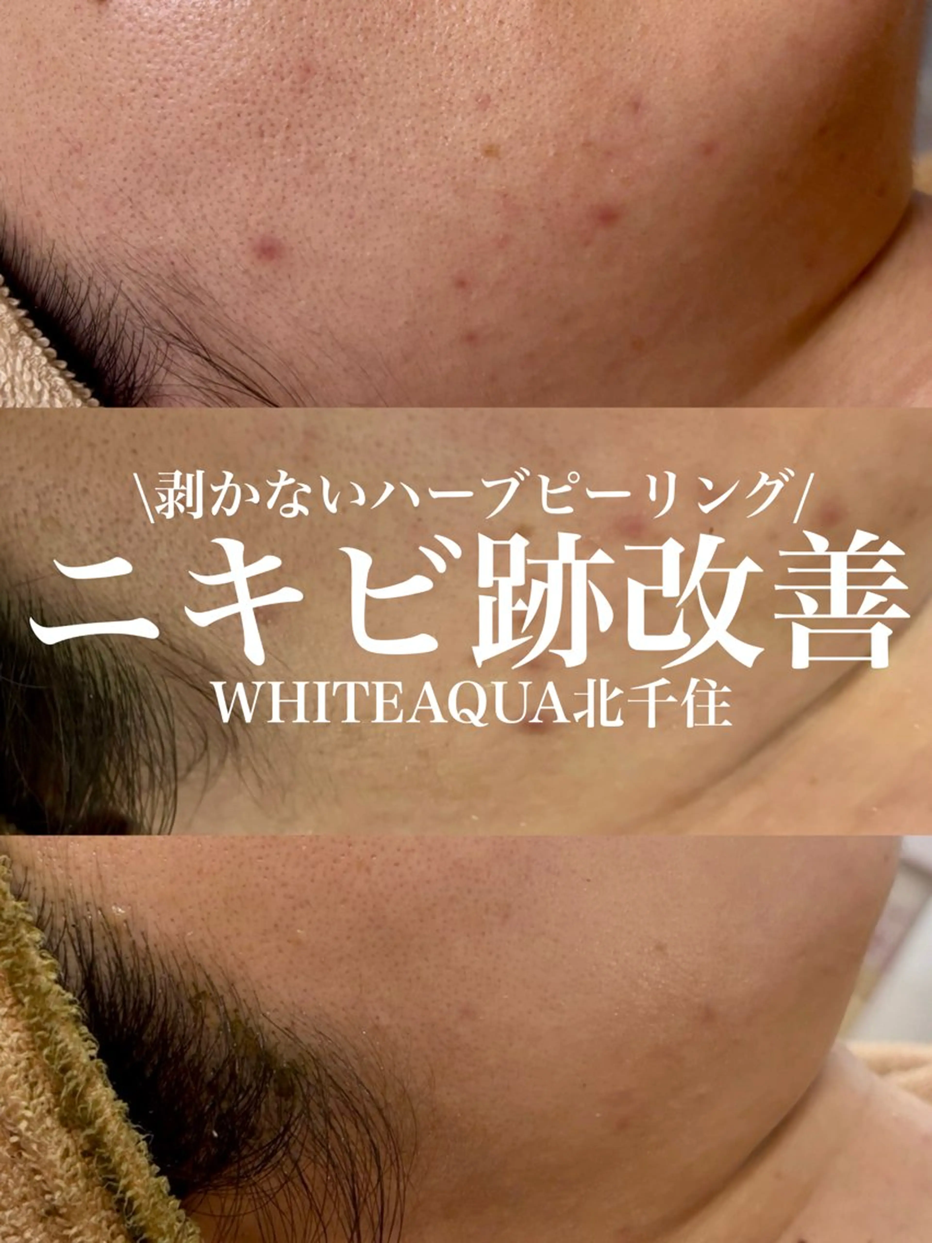 エステ WHITE AQUA 北千住店のエステ・リラクイメージ