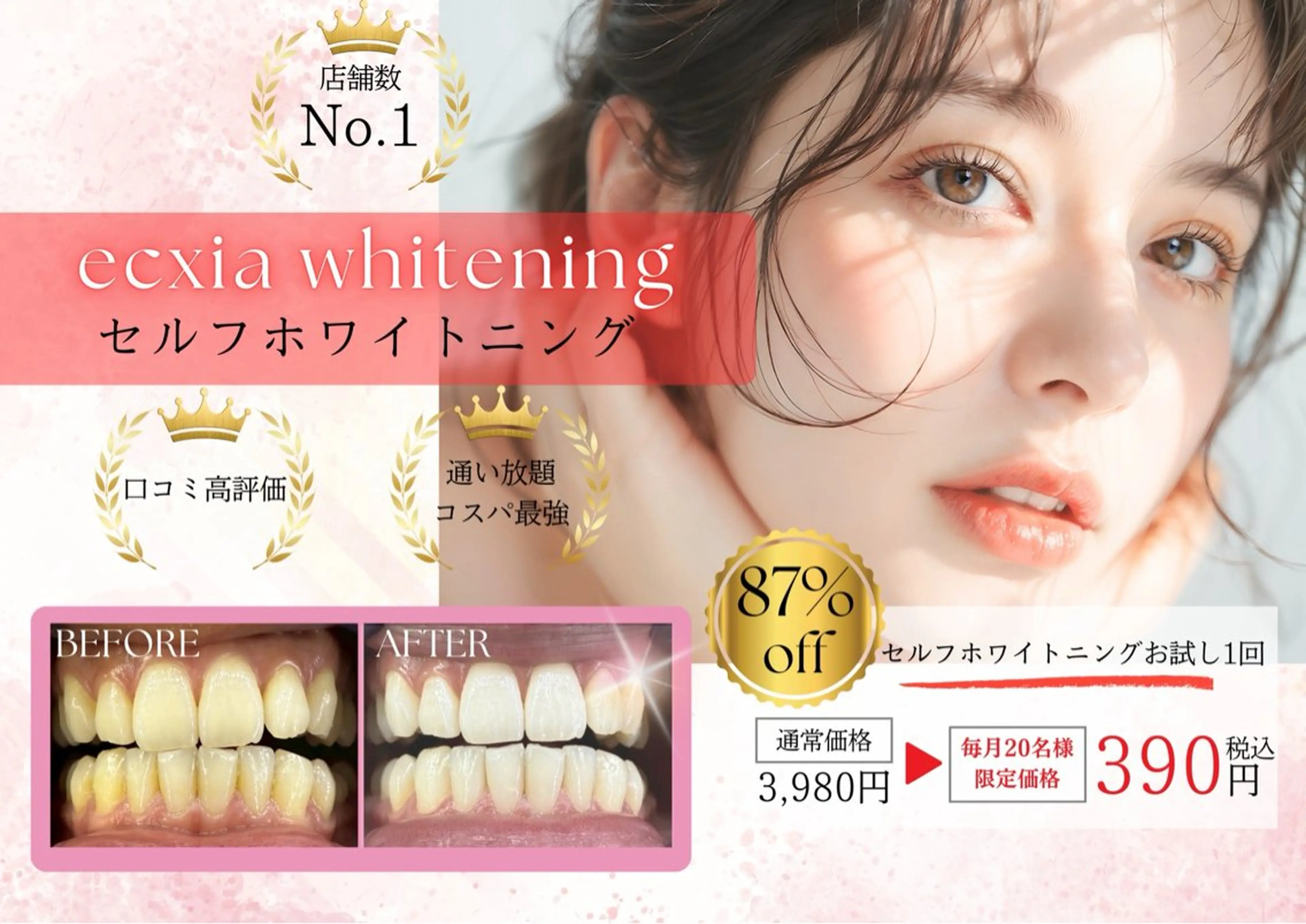 【minimo 掲載記念】セルフホワイトニング【9分✕2回】¥980別途料金なしの写真