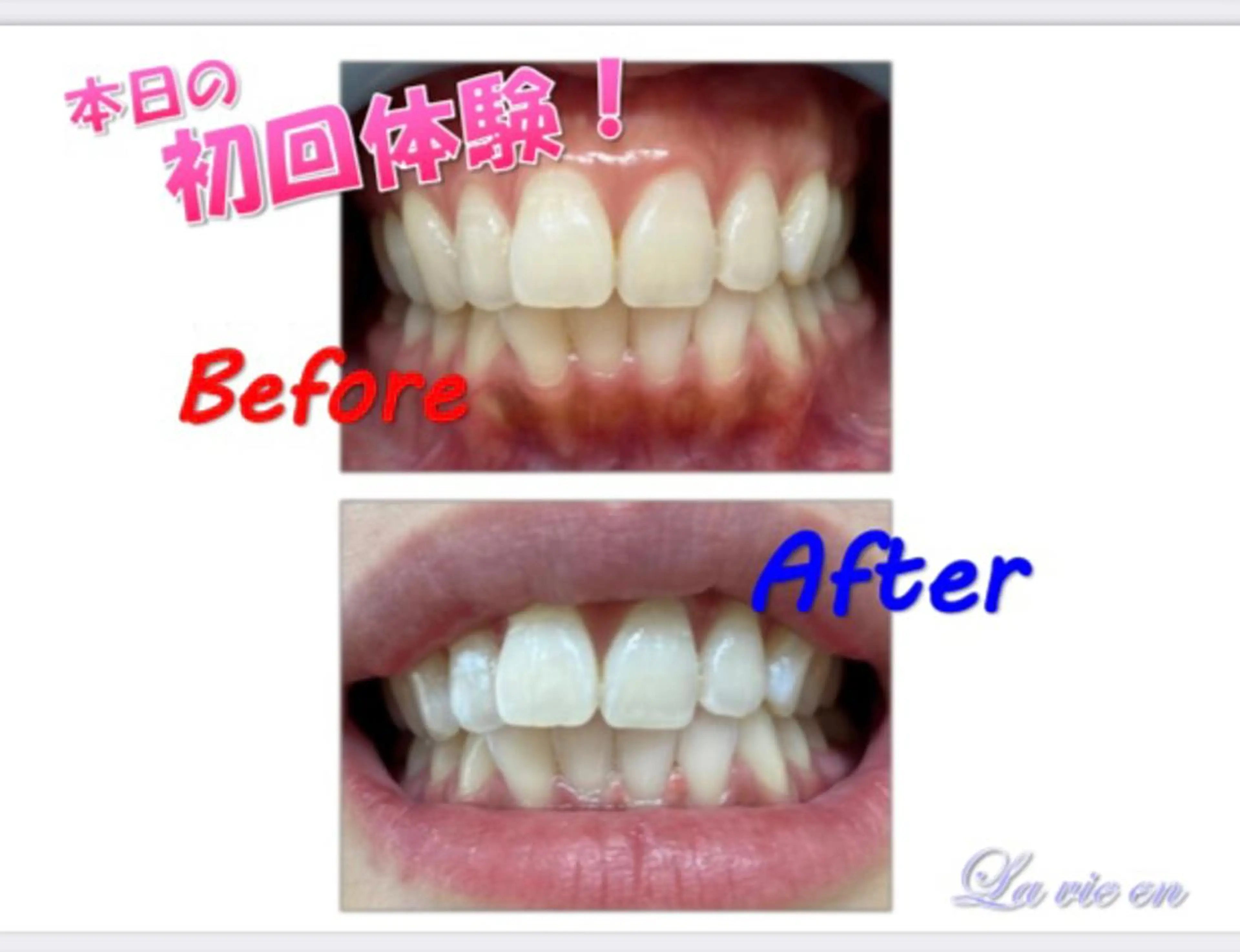 その他 セルフホワイトニングサロン　ラヴィアン所属・ホワイトニングサロン La vie enのその他イメージ