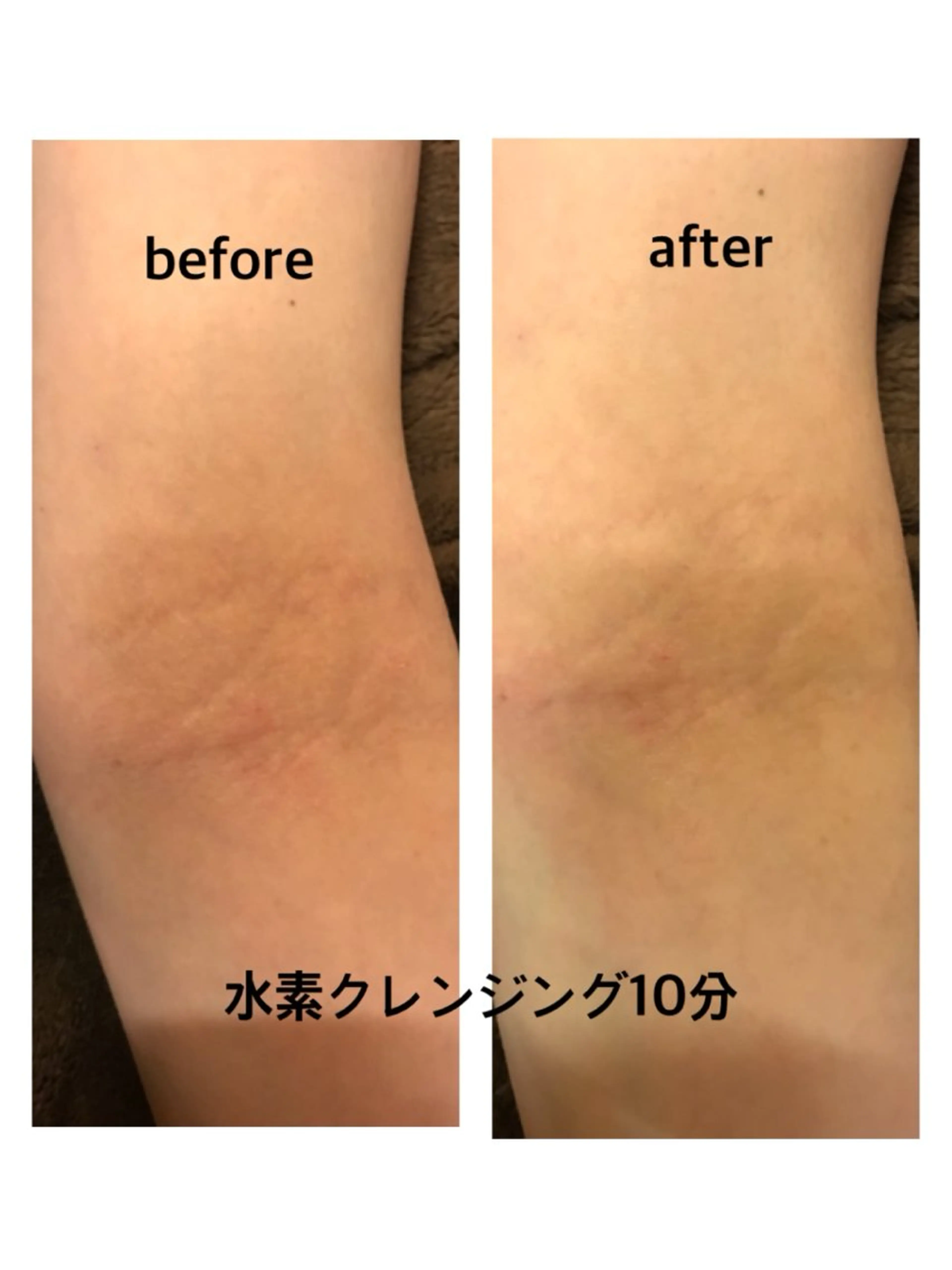 ビューティーラウンジ A&A✨佐藤✨のエステ・リラクイメージ