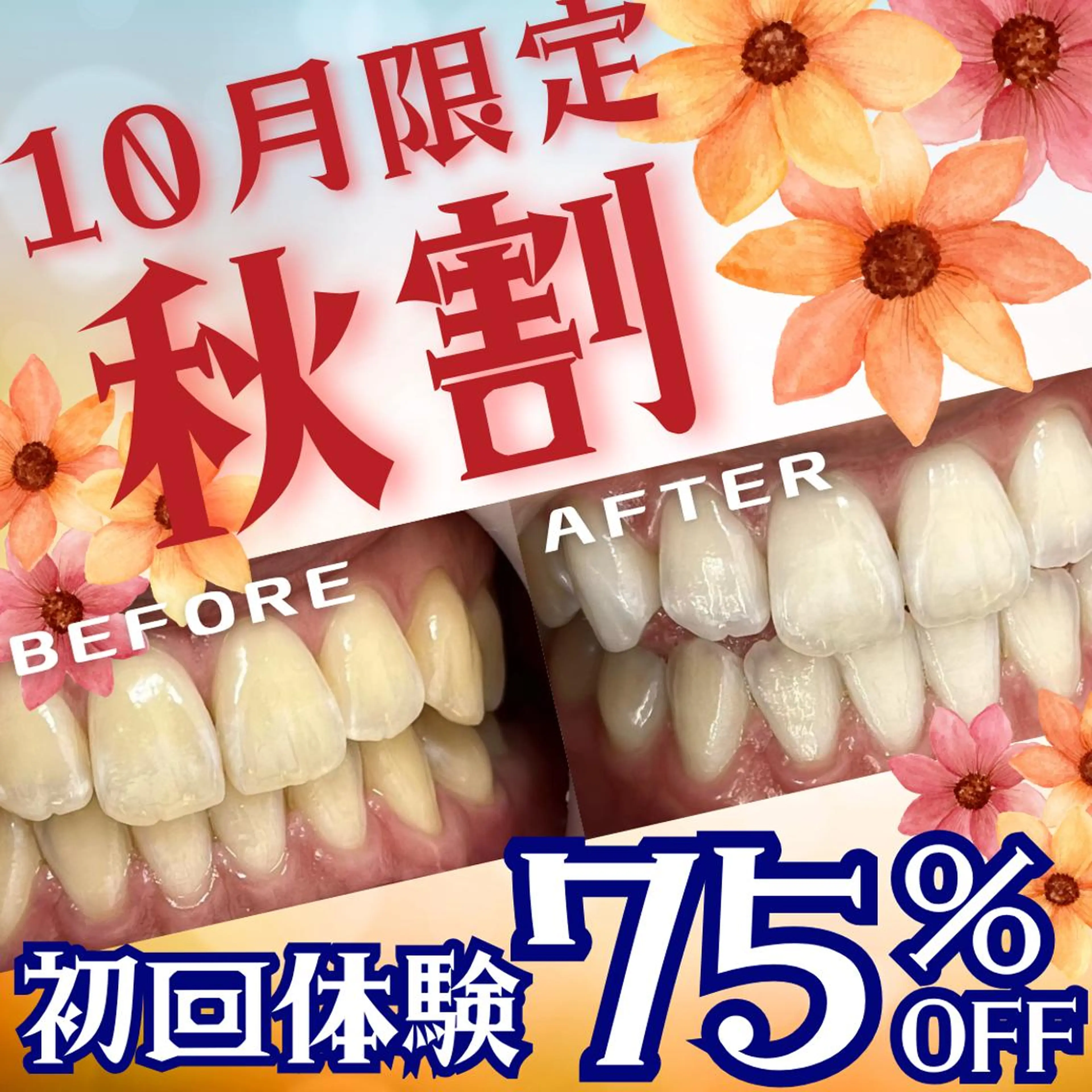 【10月限定💖秋割🍁】8分照射×２回の大人気セルフホワイトニング🦷痛み・食事制限なし❢白い歯で垢抜け🎀の写真
