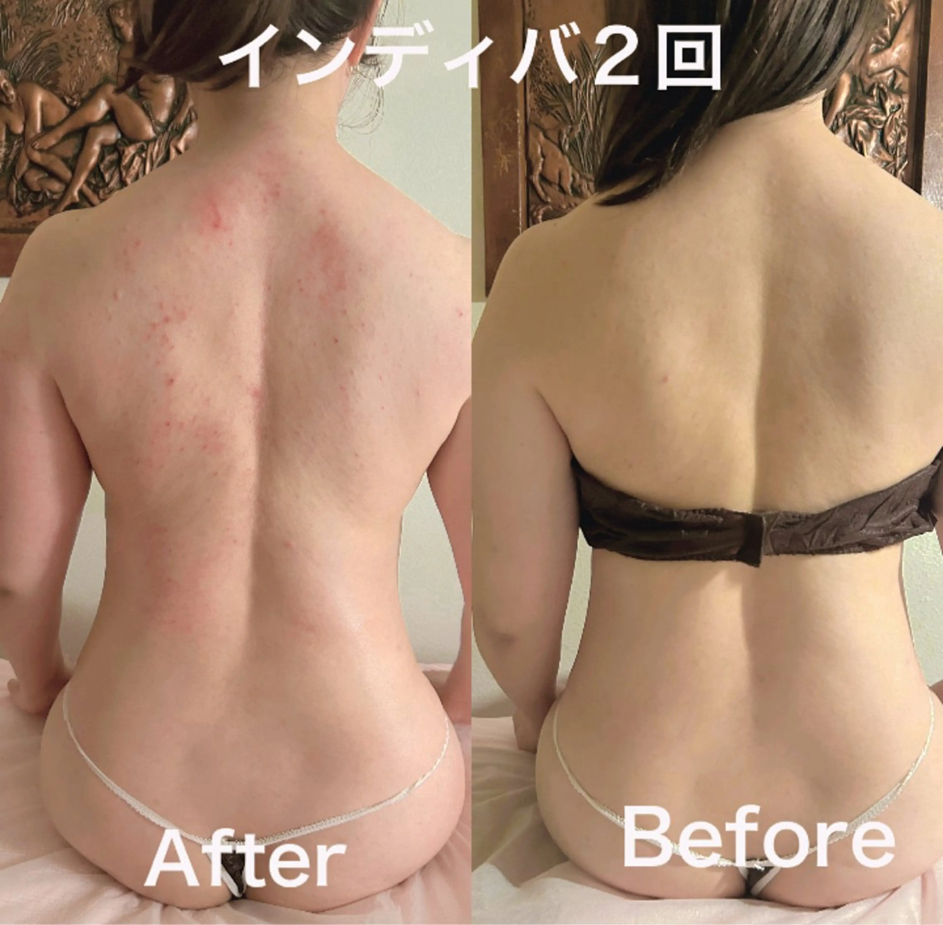 エステ リラク 【ハイパーナイフ痩身&小顔コルギ&ハーブピーリング】K-Beauty　東新宿所属・kーbeauty痩身 フェイシャルのエステ・リラクイメージ