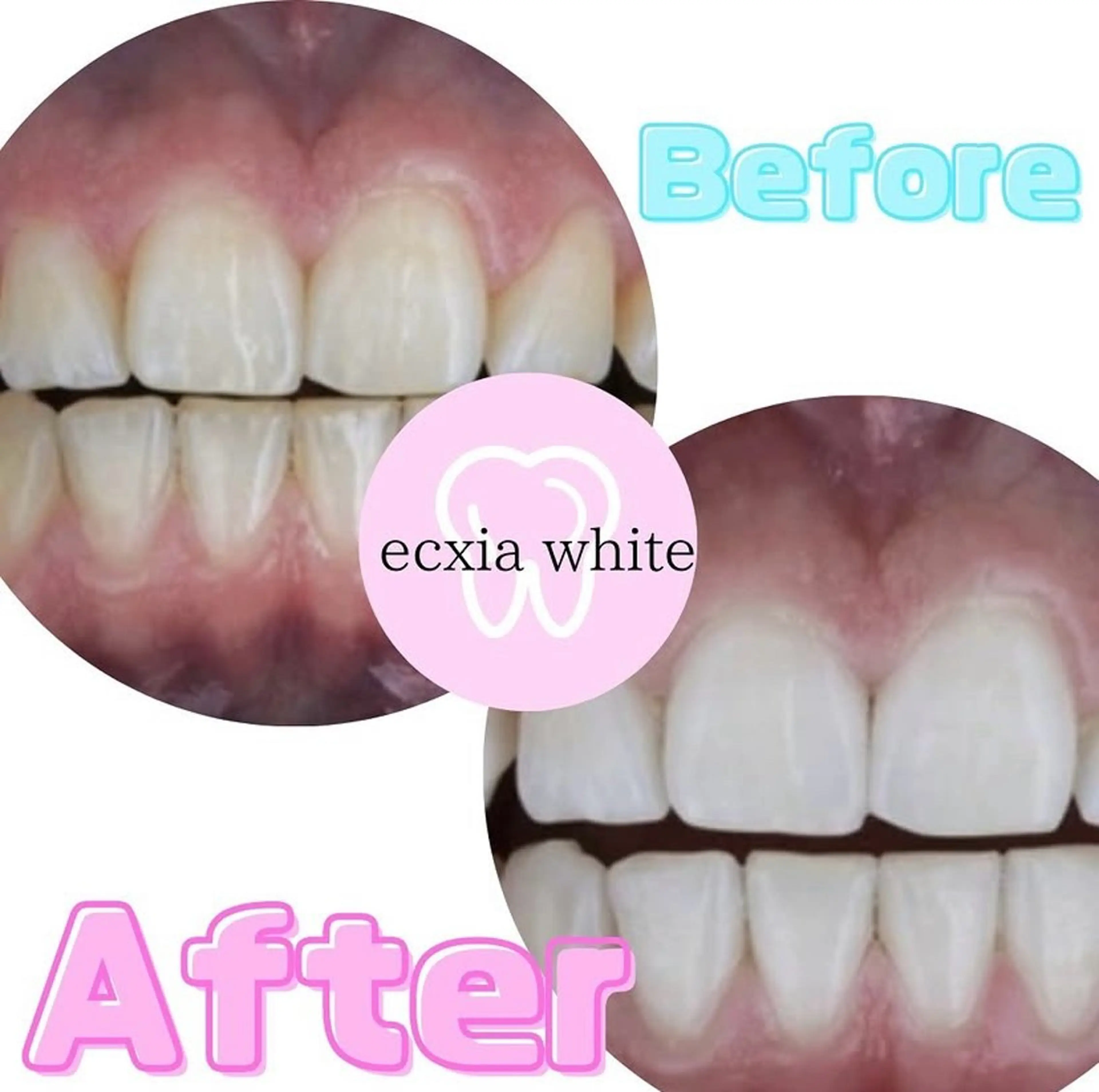 その他 エクシアホワイトニング草津店所属・nanami -ホワイトニングのその他イメージ