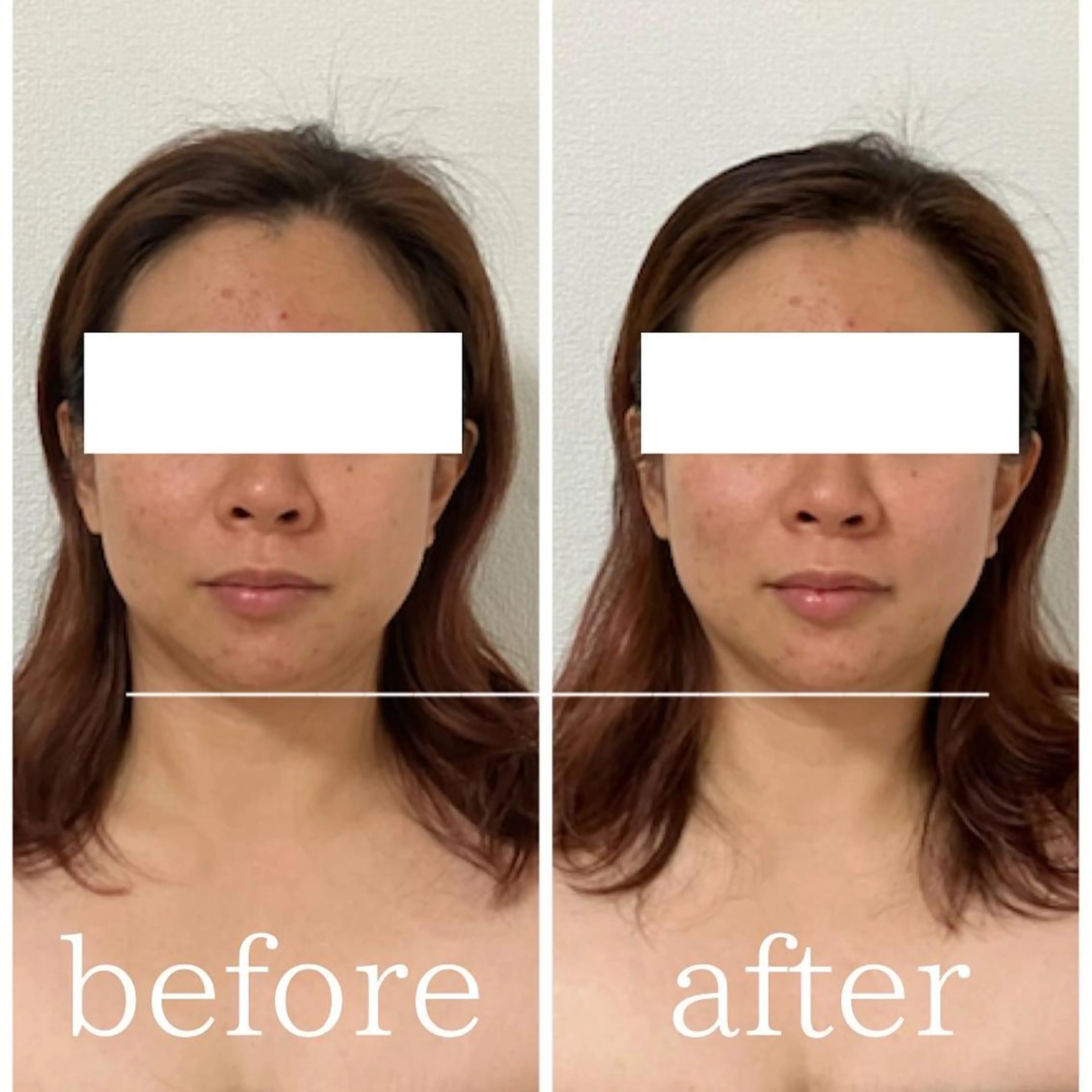 毛穴ケア専門サロン Yourmeユアミーのエステ・リラクイメージ