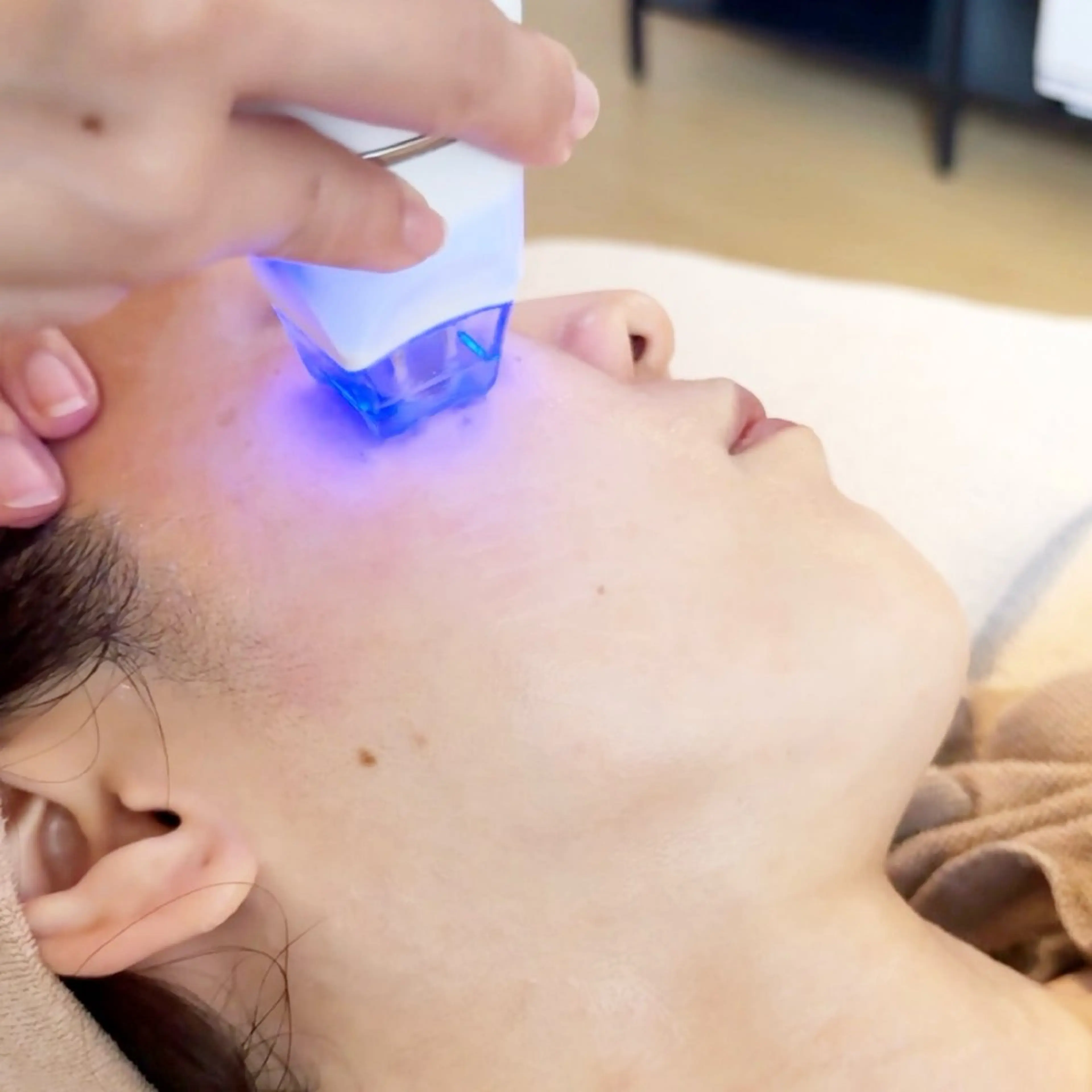 人気No.1🤍🩵AIR美容鍼トリートメント◎日本初上陸!針を刺さない美容鍼◎小顔/くすみ/美白/たるみ/クマの写真