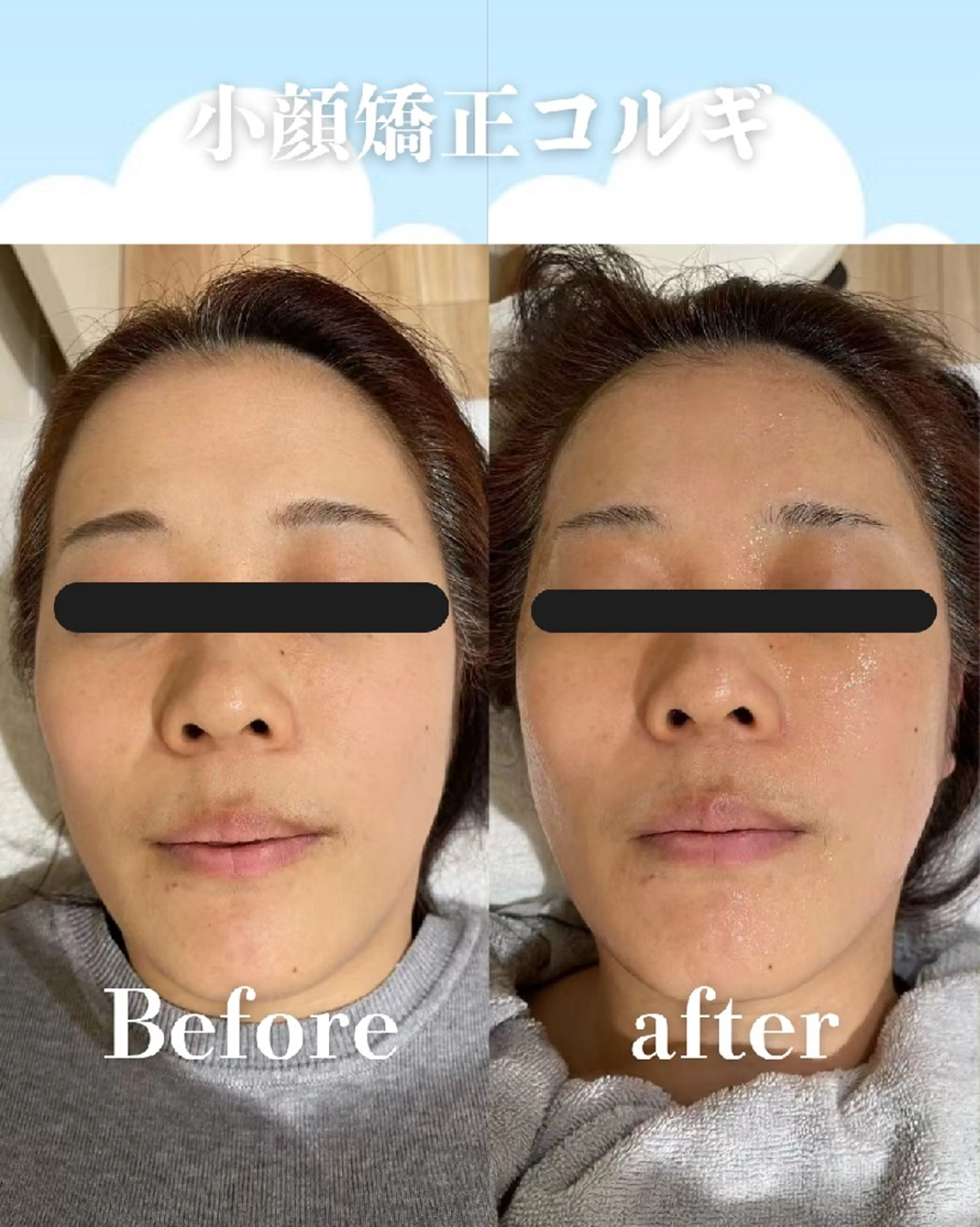 エステ リラク 高岳/久屋大通　脱毛 コルギ🌿ENSHIのエステ・リラクイメージ