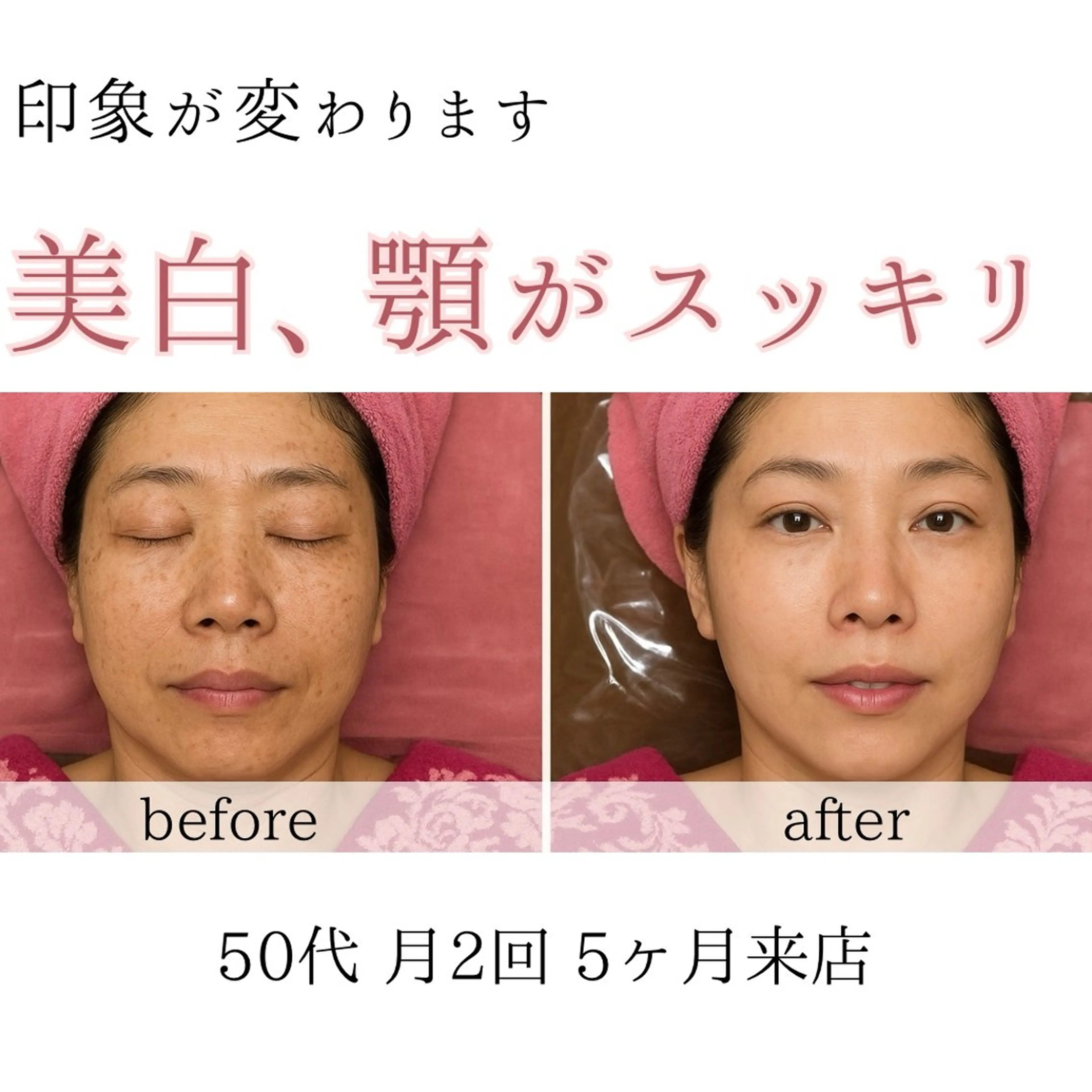 オアシス・さくら所属・自然美人を叶える小顔 と脱毛サロンのエステ・リラクイメージ