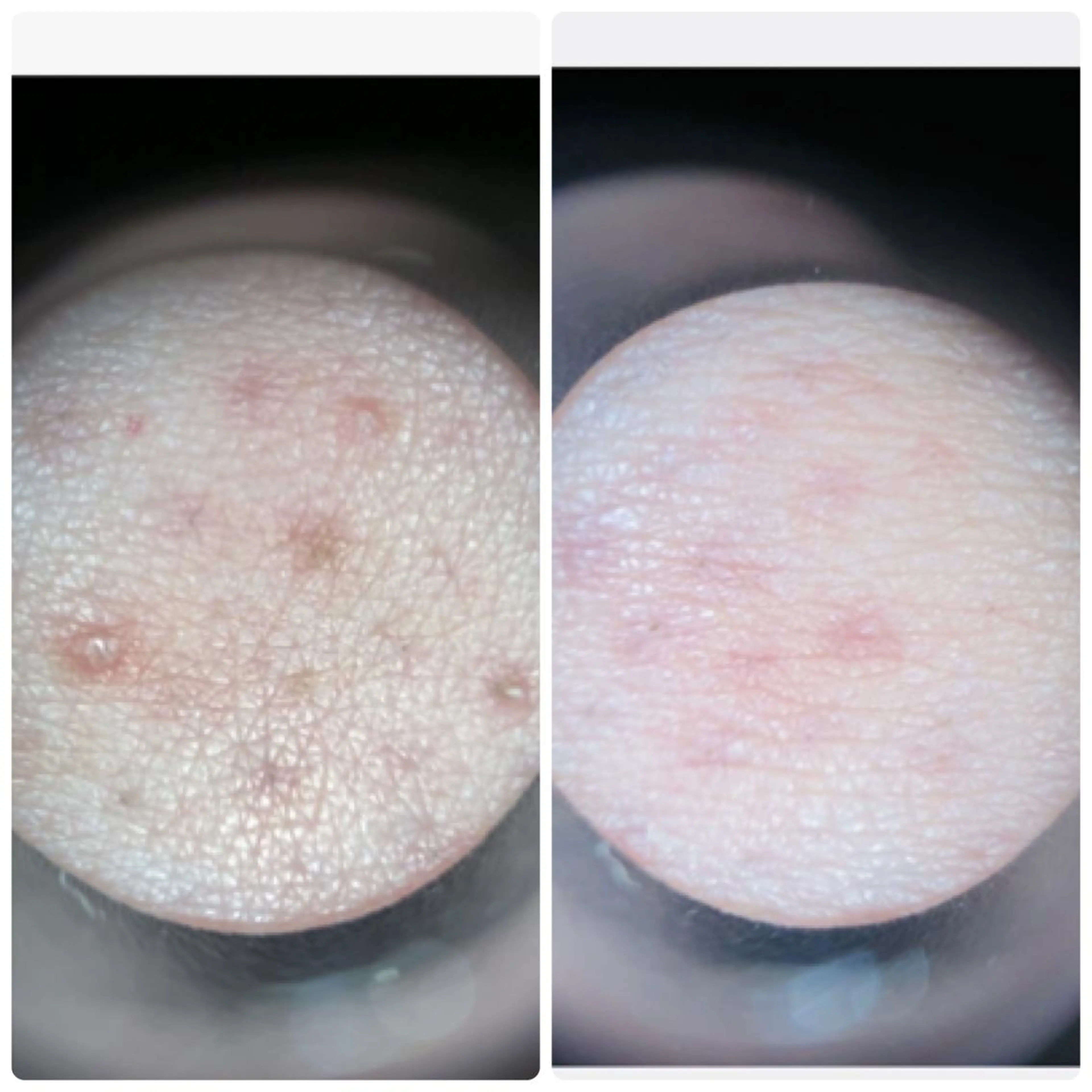 FLEUR大阪・整体 ・ハイフ・痩身・小顔のエステ・リラクイメージ