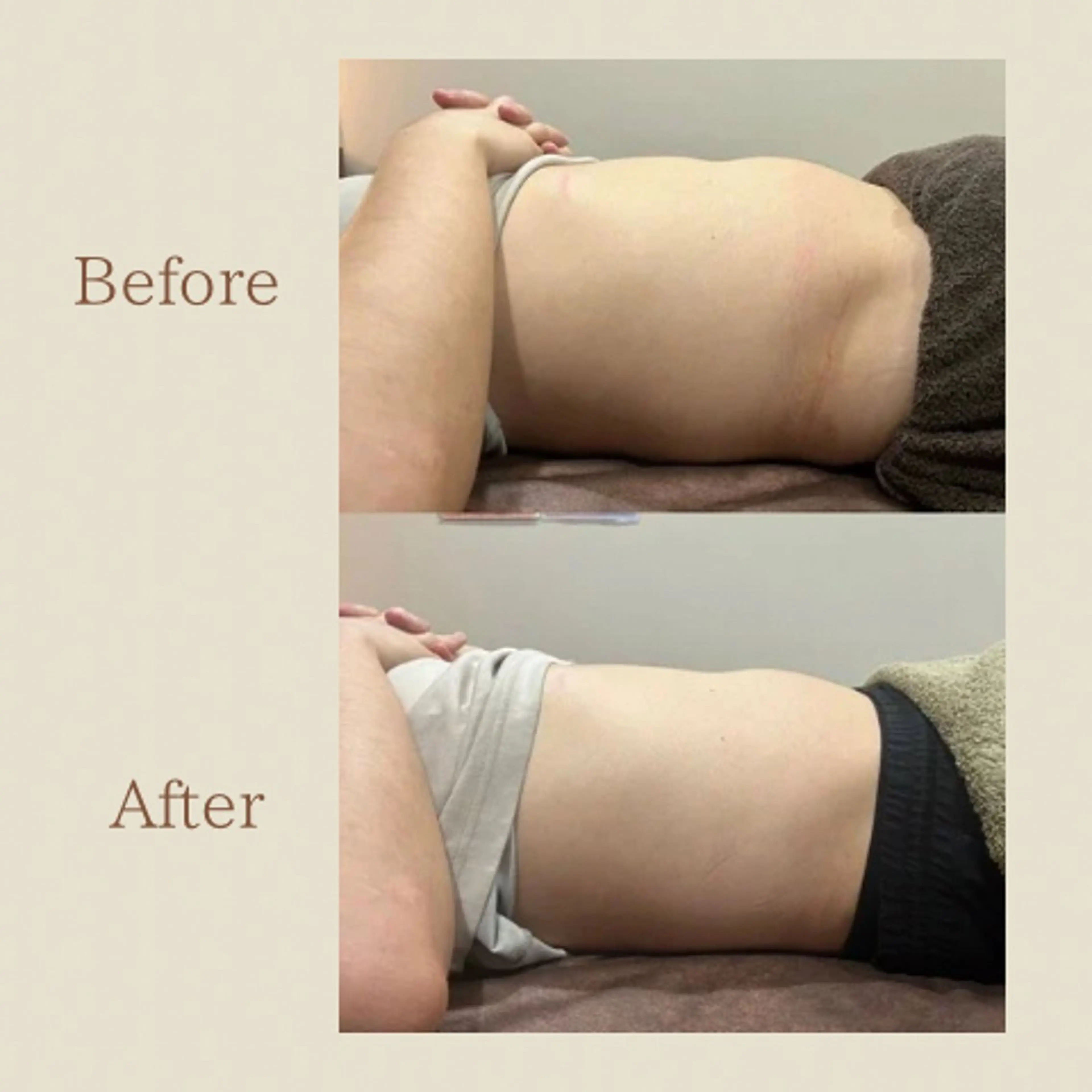 お腹痩せエステ Flat BELLY 恵比寿所属・【腸もみ/脂肪冷却】 お腹エステ/恵比寿のエステ・リラクイメージ