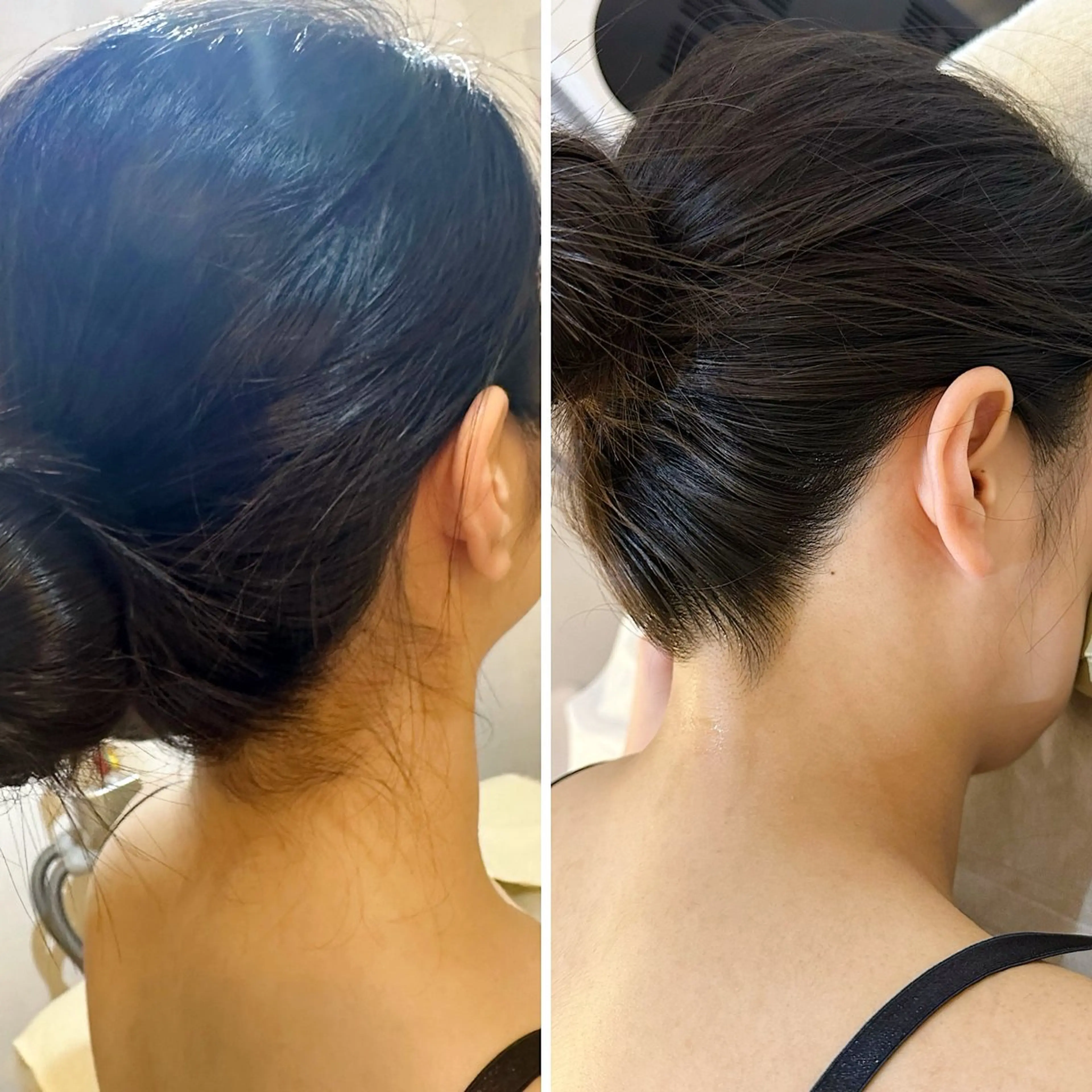 脱毛 うなじ脱毛/美肌脱毛 LABELのエステ・リラクイメージ