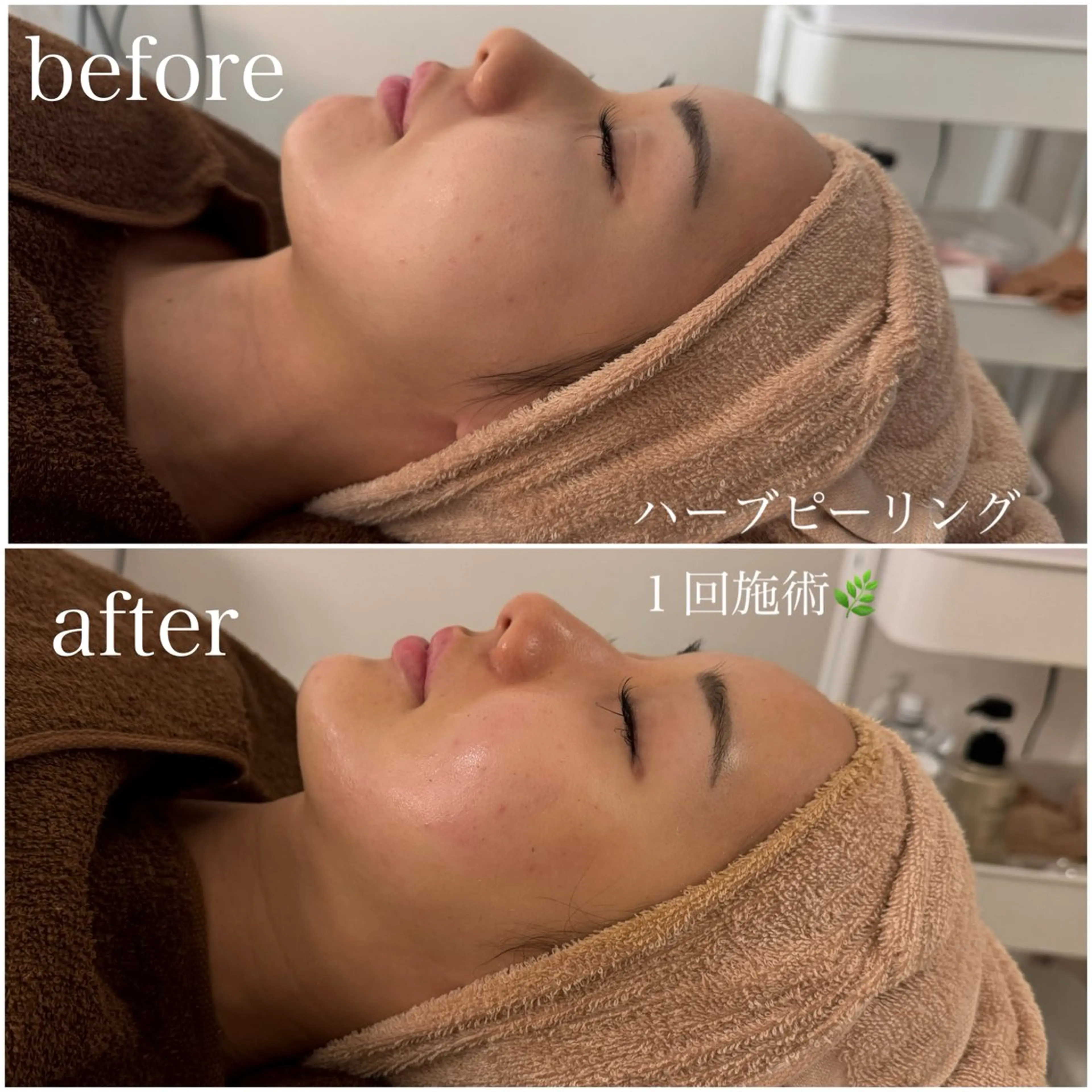 エステ 23beauty所属・武藤 那月のエステ・リラクイメージ