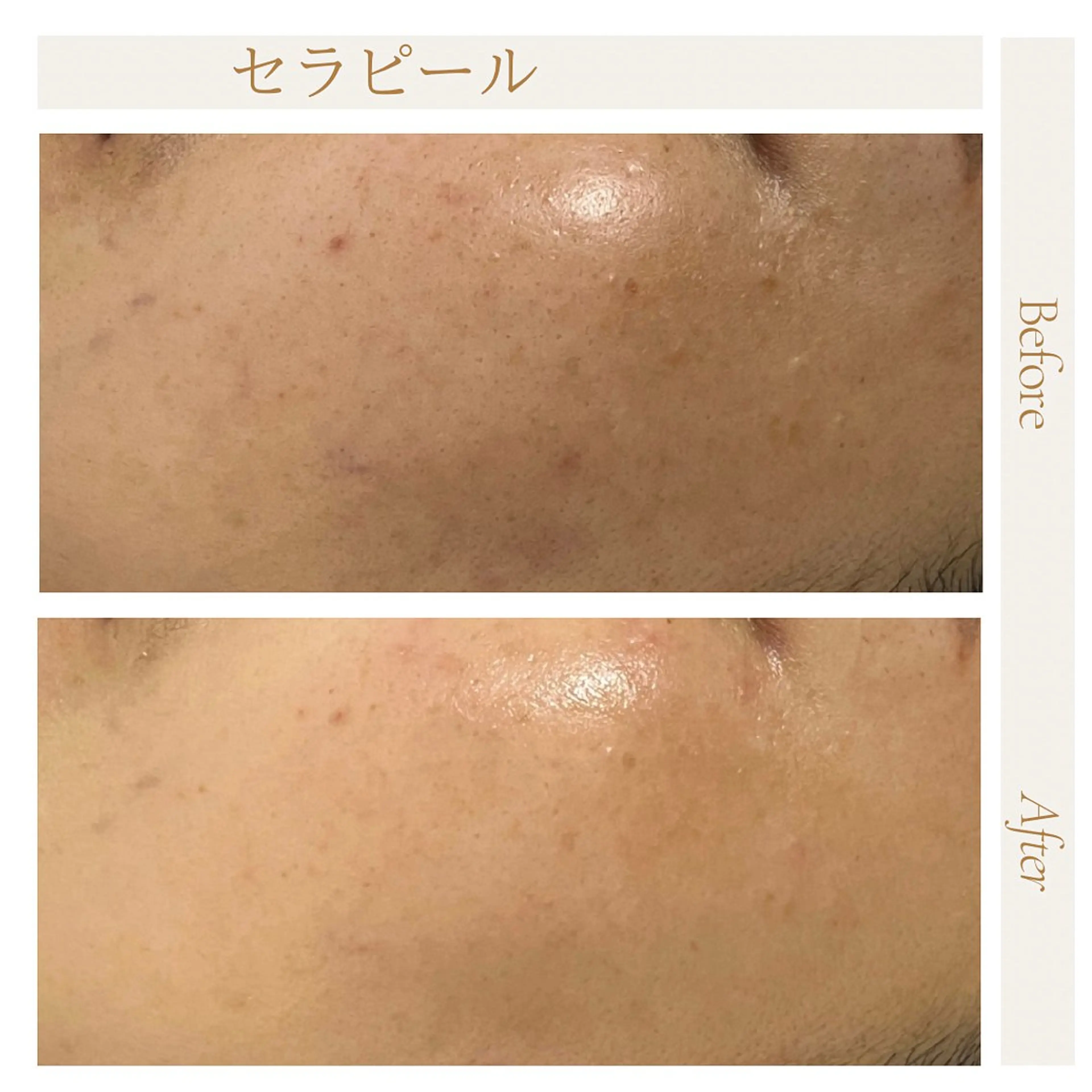 privatesalon icca所属・mana iccaのエステ・リラクイメージ