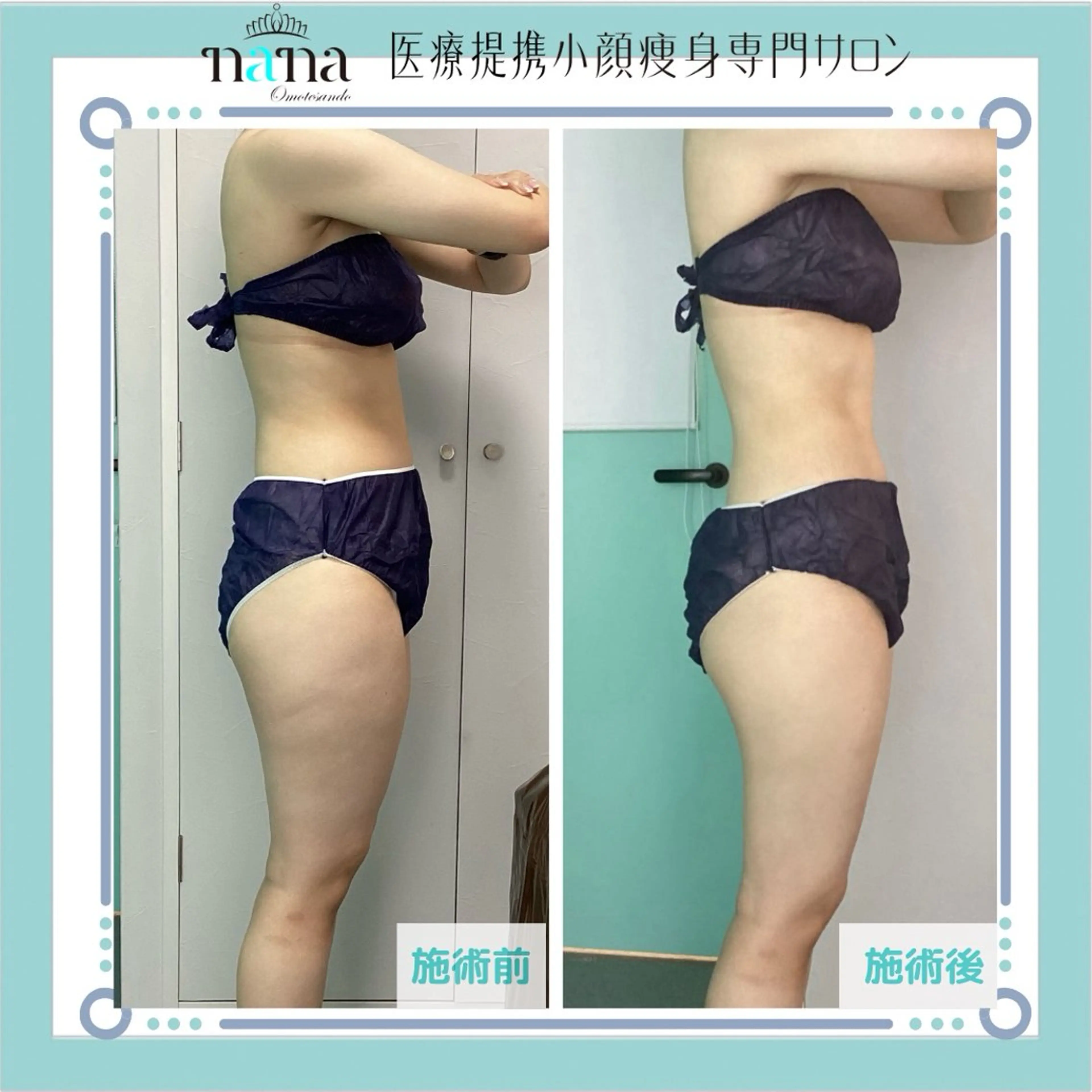 メンズ 小顔痩身インディバ Nana表参道のエステ・リラクイメージ