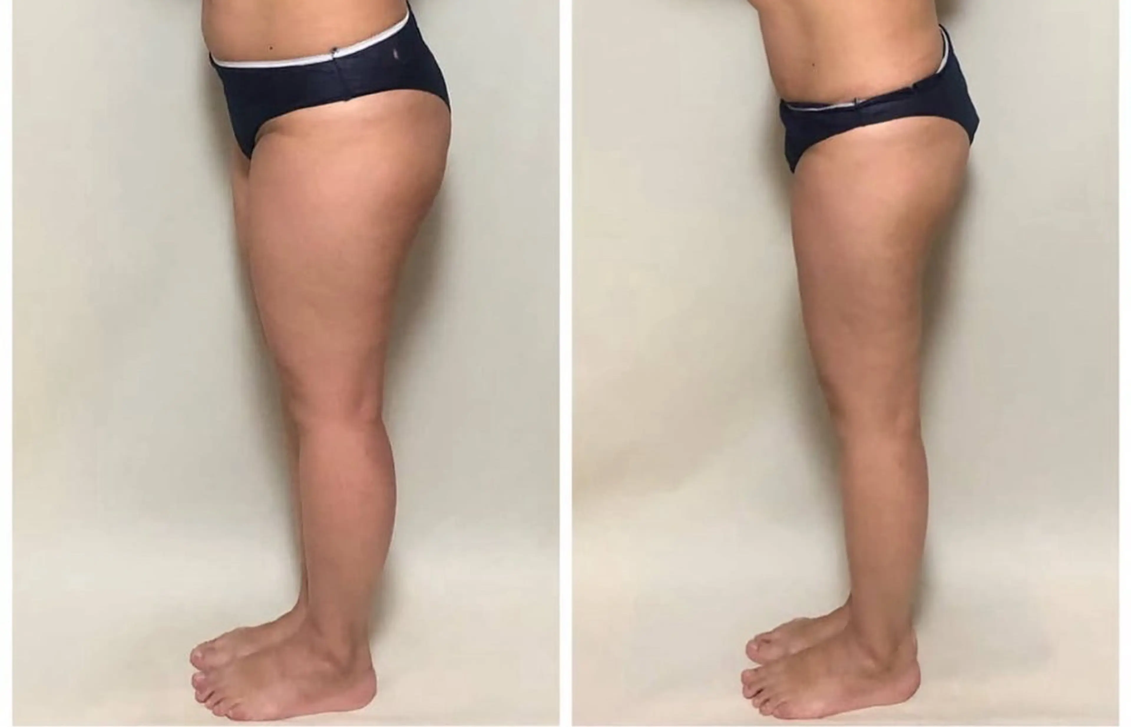 エステ リラク salon lady_goのエステ・リラクイメージ