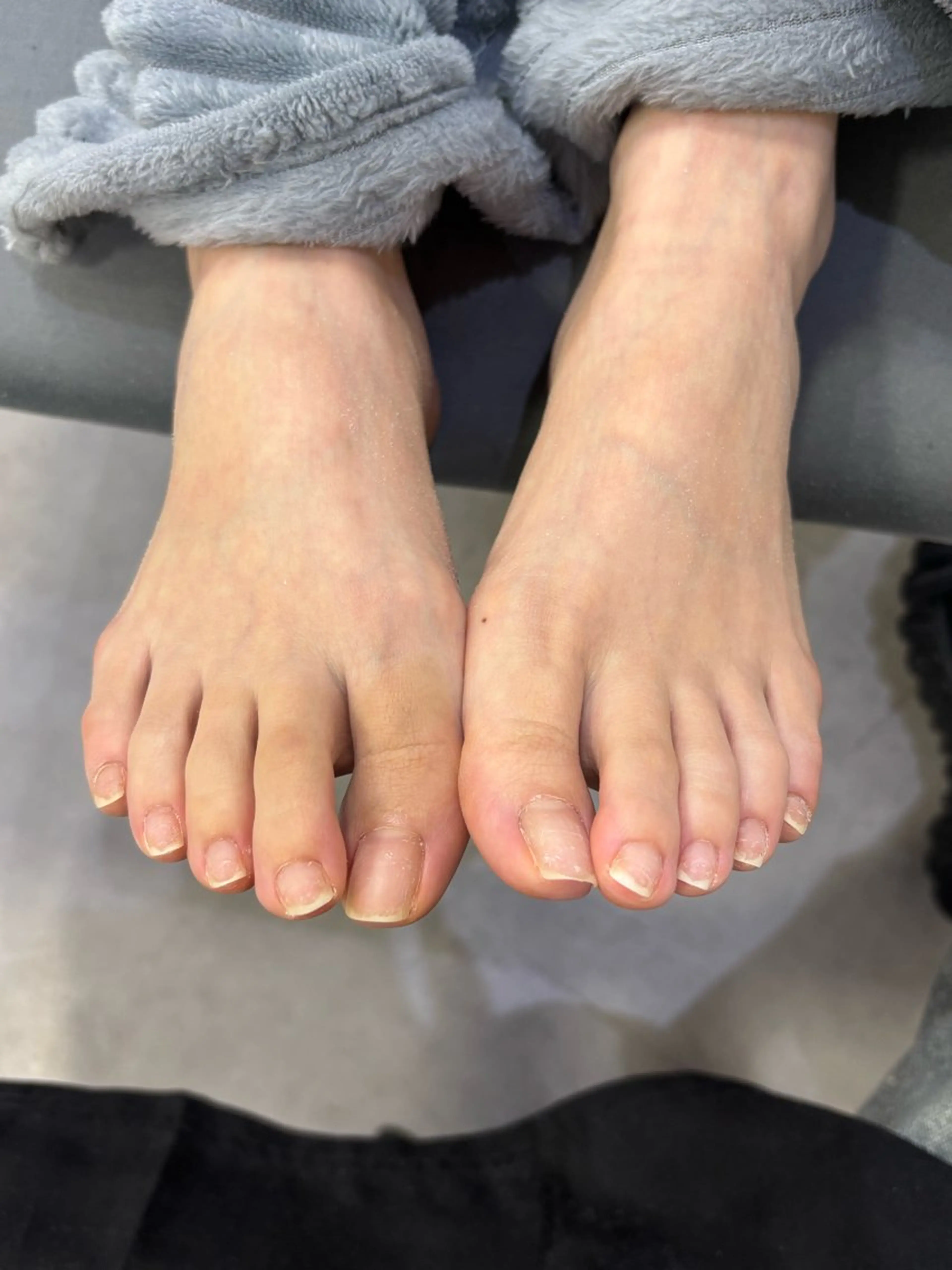 ãã€ã« ðŽð¶ðµð¬ ã¢ãã«åéäžã®ãã€ã«ãã¶ã€ã³