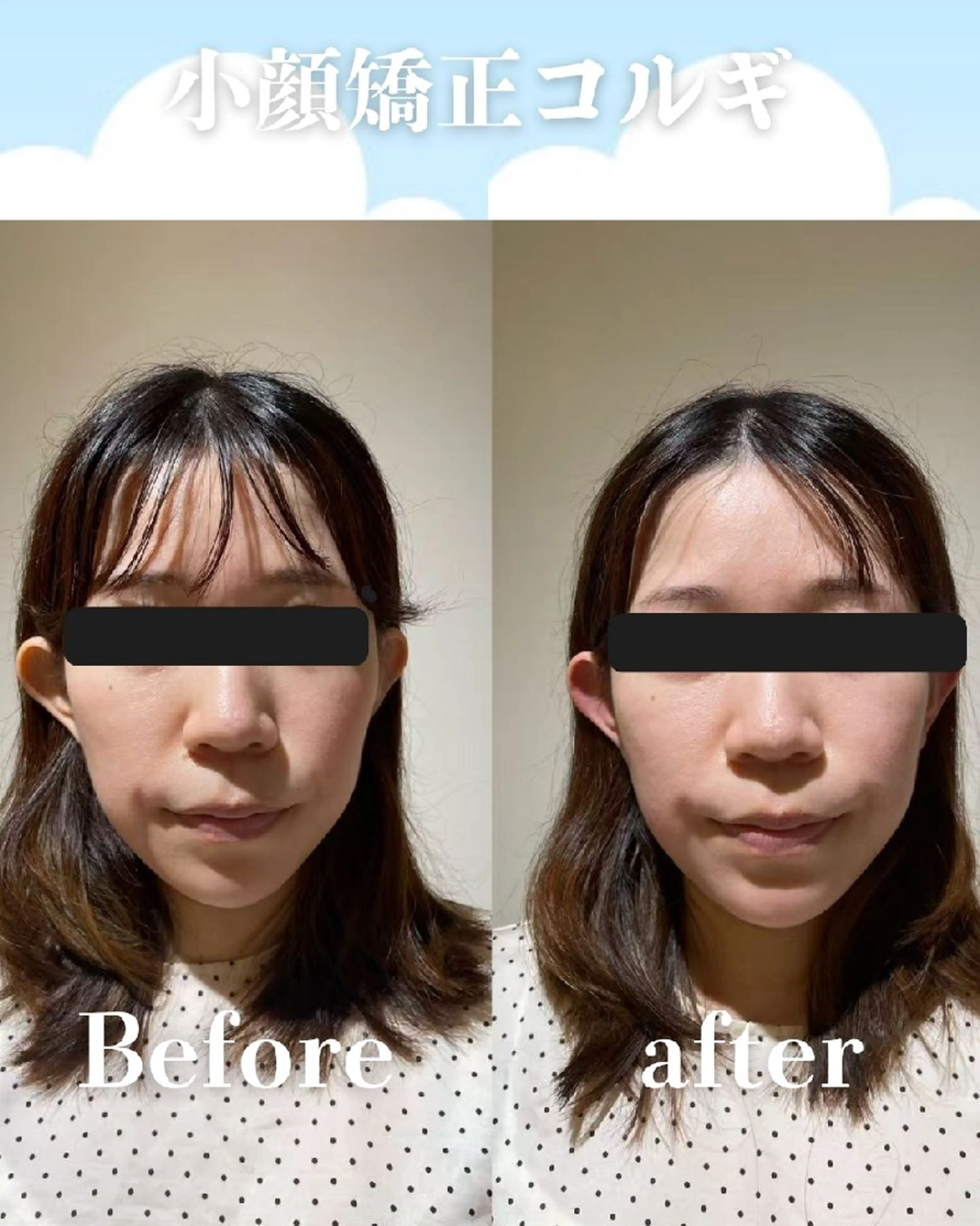 高岳/久屋大通 脱毛 コルギ🌿ENSHIのエステ・リラクイメージ