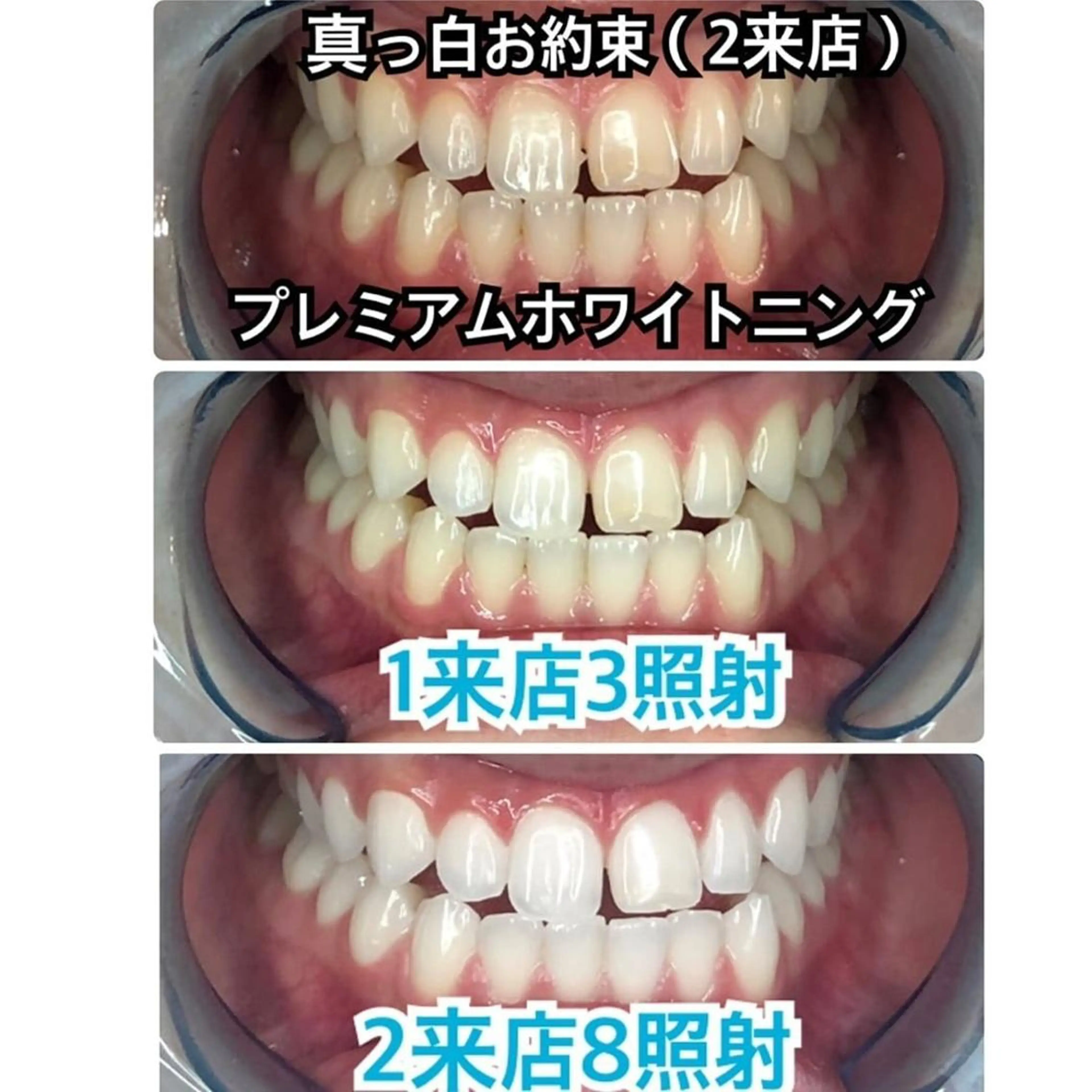 Platinum Beauty 四条烏丸店所属・吉田亮利 ホワイトニング専門店のその他イメージ
