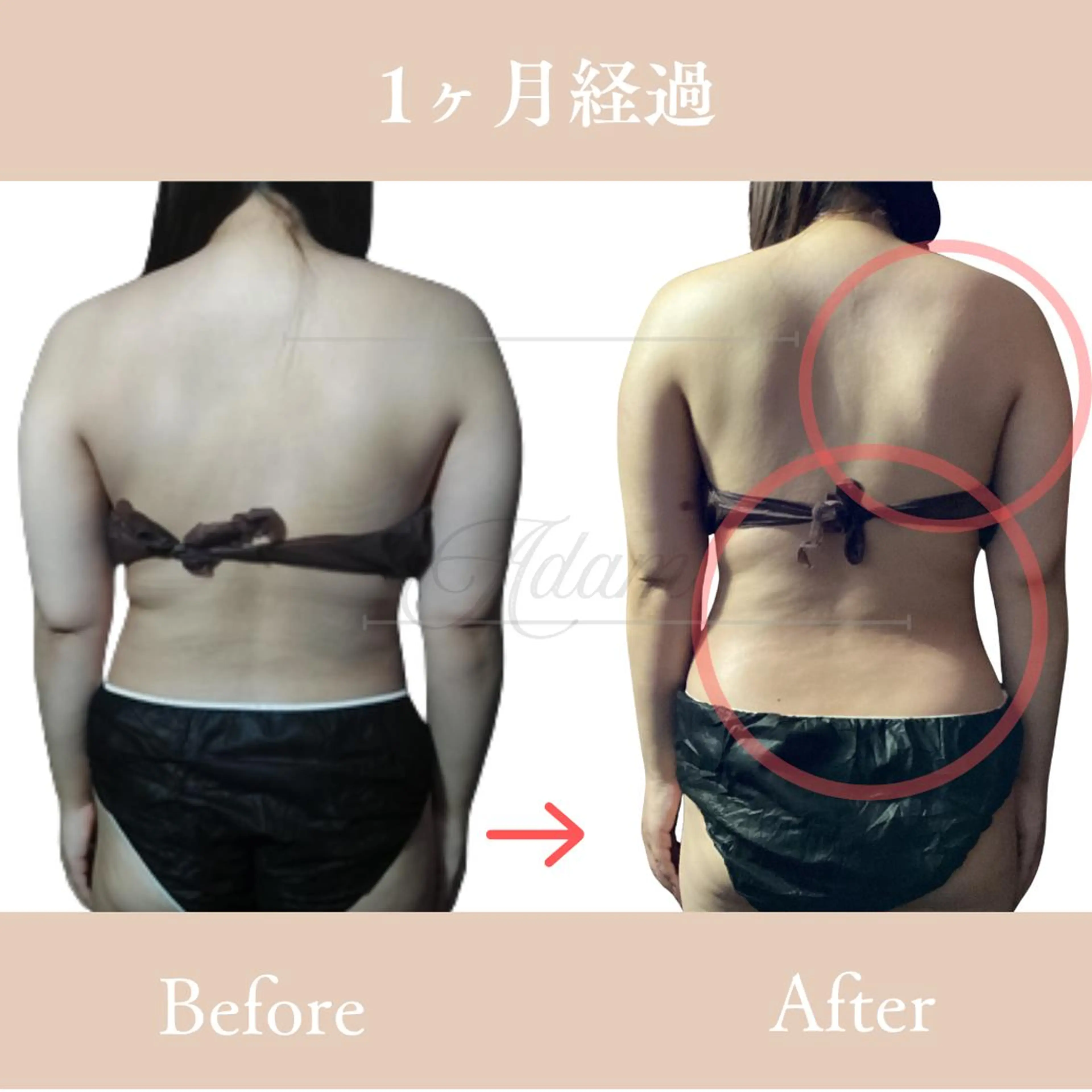 【上半身セット】上半身全部が込みのセットケアの写真