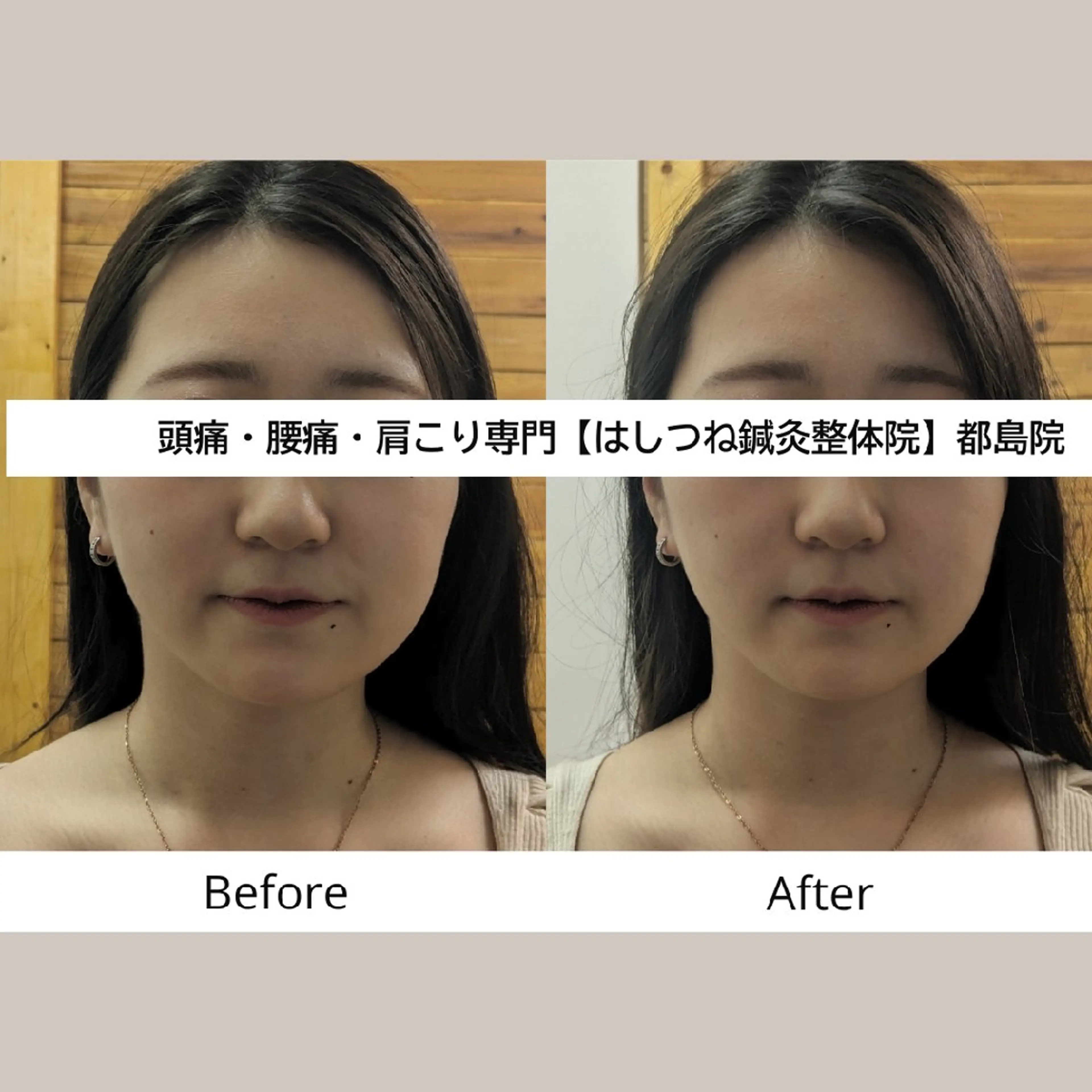リラク 頭痛・腰痛・美容鍼に 特化してます。　橋岡のエステ・リラクイメージ