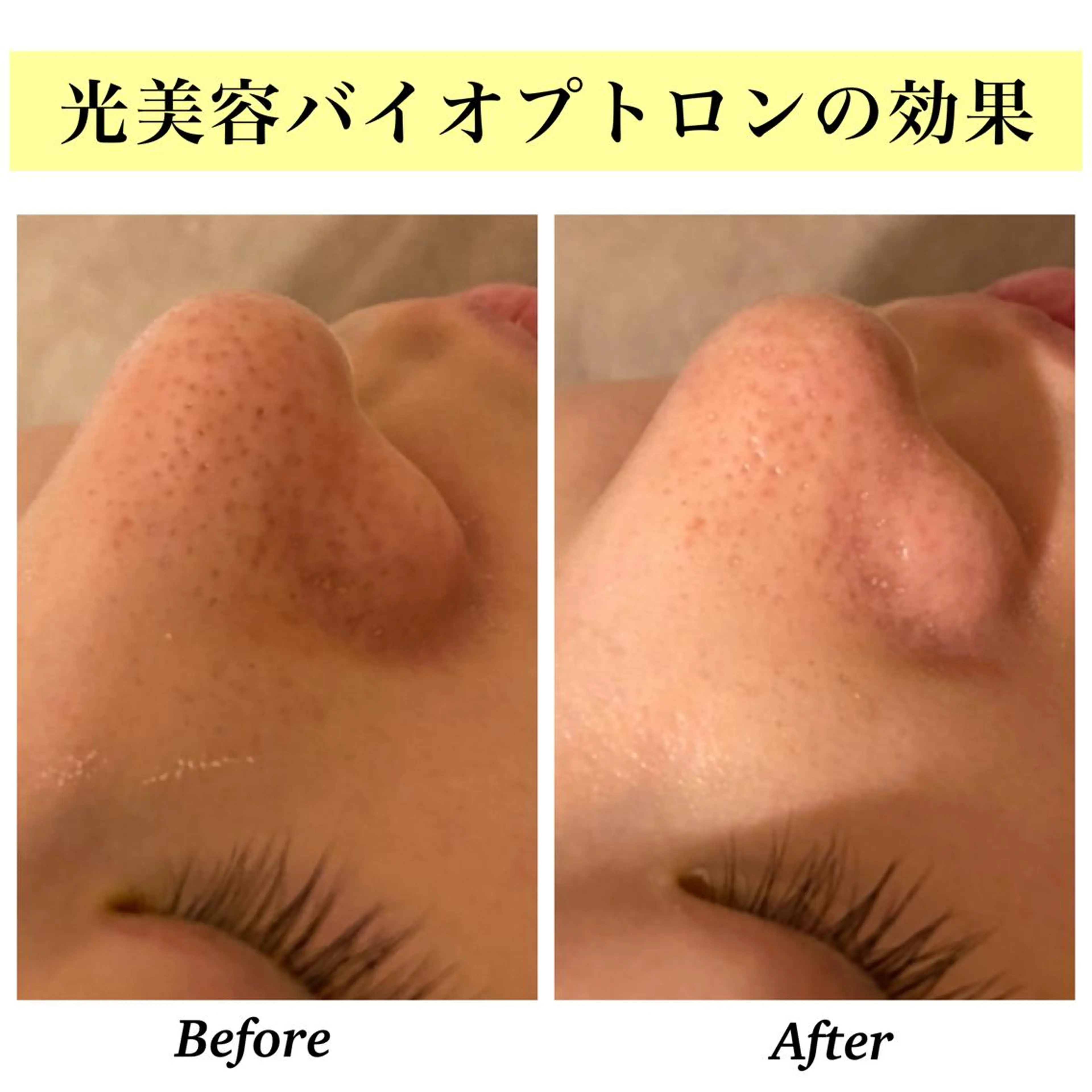 エステ リラク Bellesthe (ベルエステ)のエステ・リラクイメージ