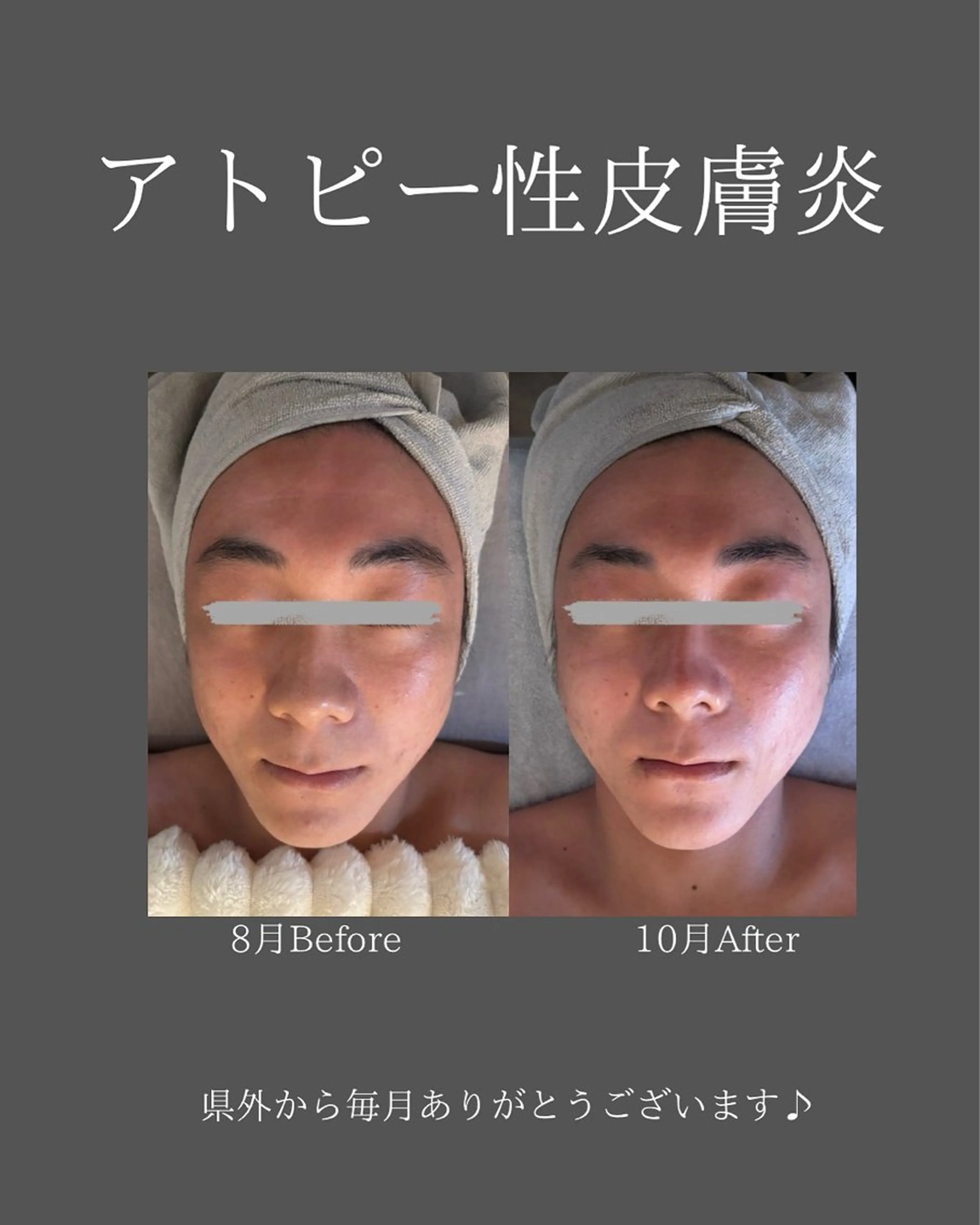 BLOSSOM 菊地のエステ・リラクイメージ