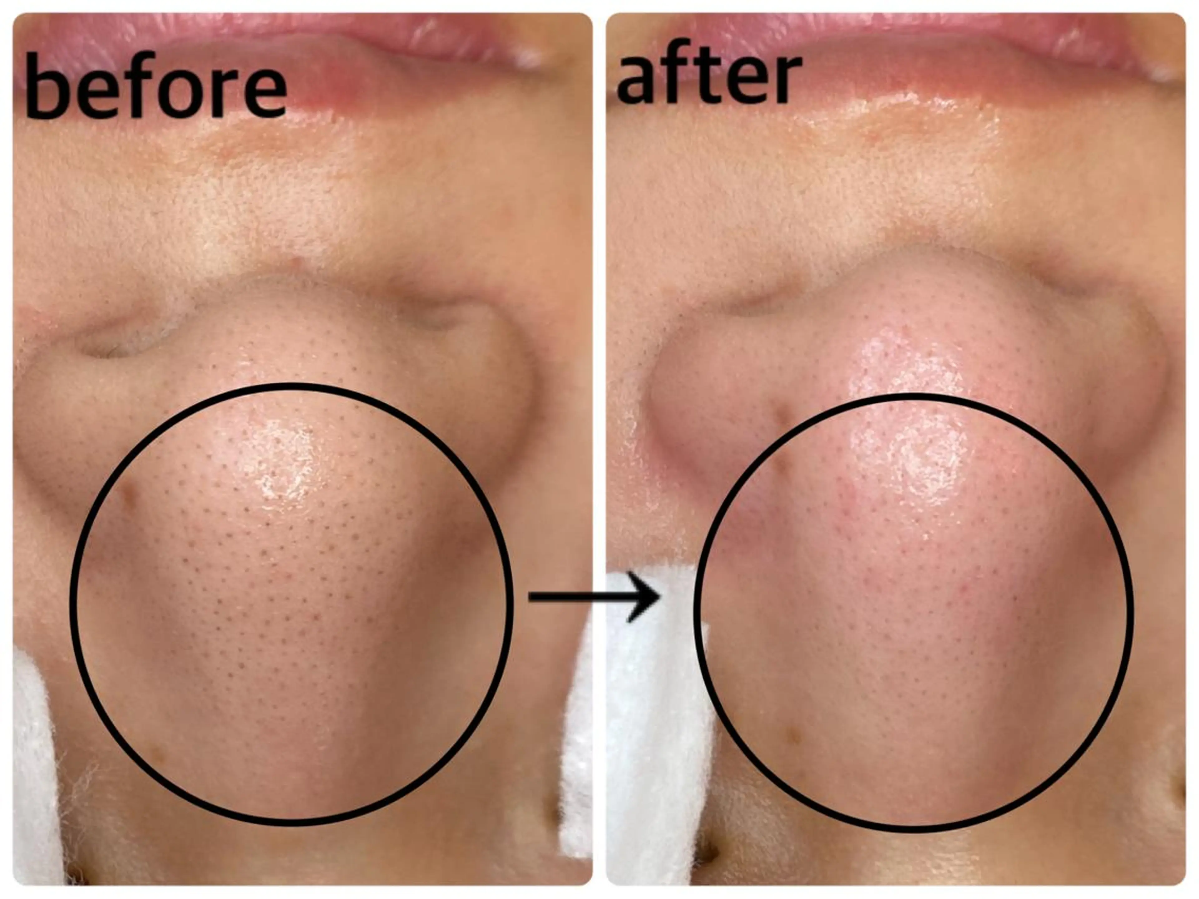 韓国肌管理 【毛穴専科】のエステ・リラクイメージ