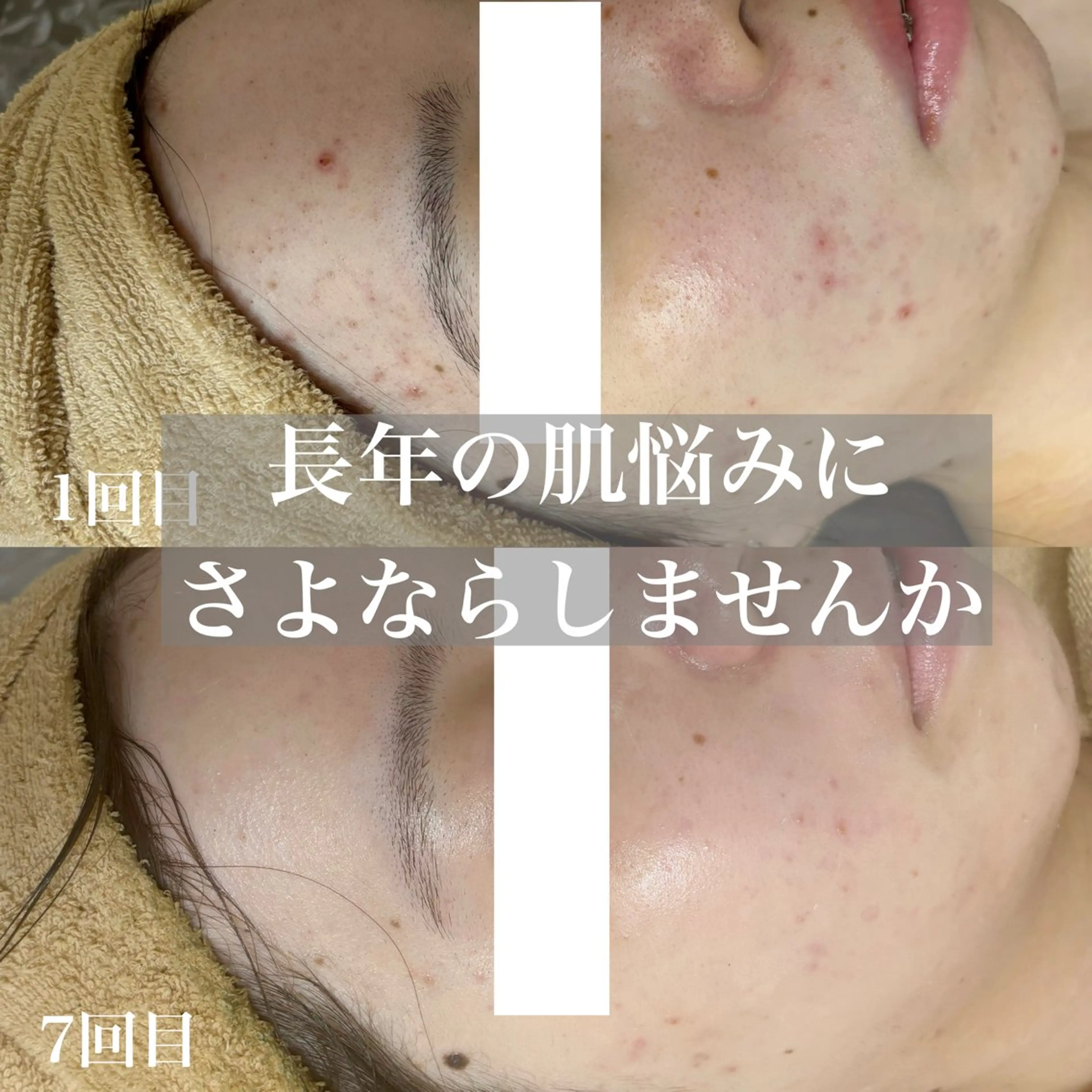 エステ WHITE AQUA 北千住店のエステ・リラクイメージ