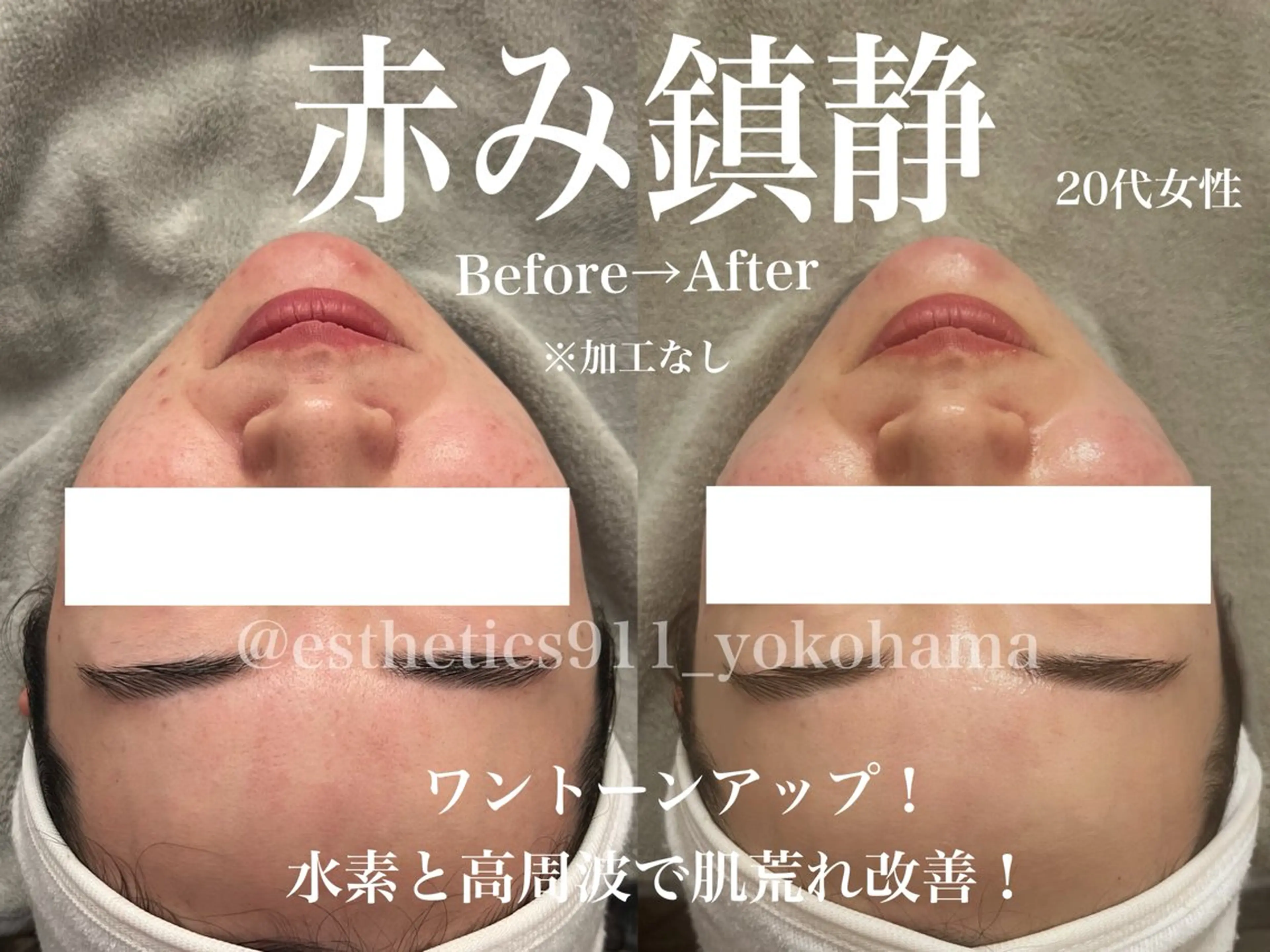 エステ リラク Esthetics911所属・Esthetics 911横浜のエステ・リラクイメージ