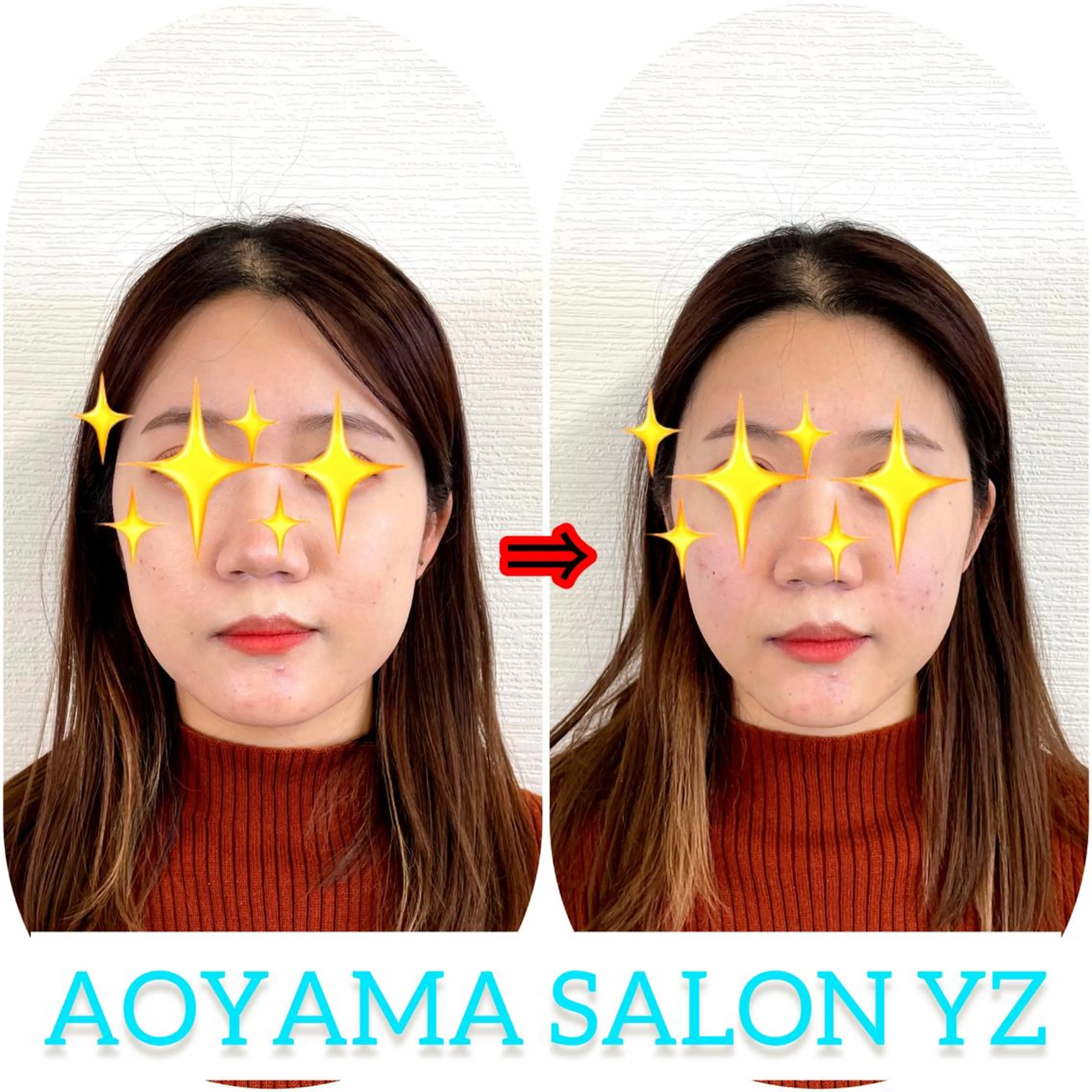 エステ リラク 小顔美容鍼専門サロン 渋谷YZのエステ・リラクイメージ