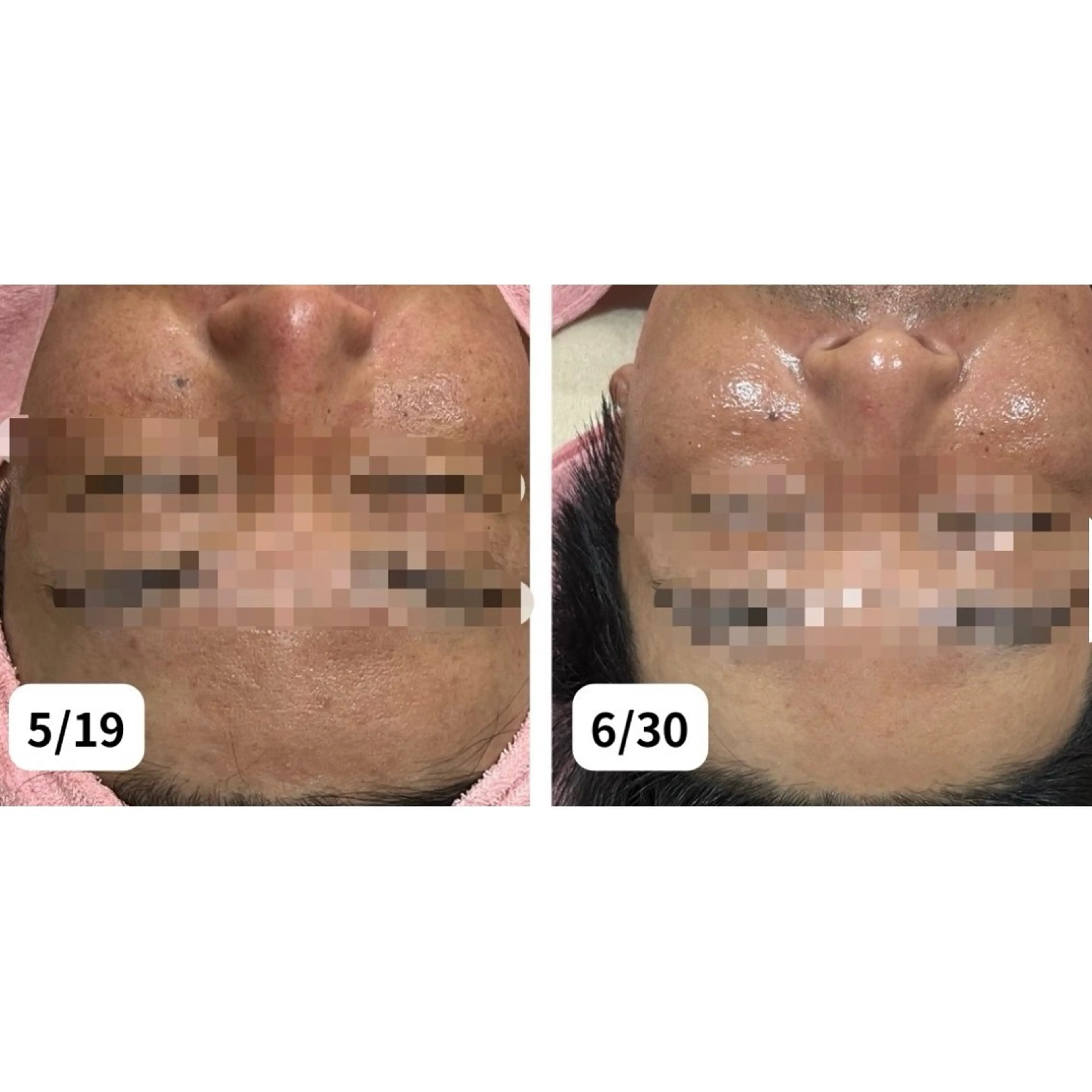 エステ フェイシャル/脱毛 ジョアアンジェ竹田のエステ・リラクイメージ