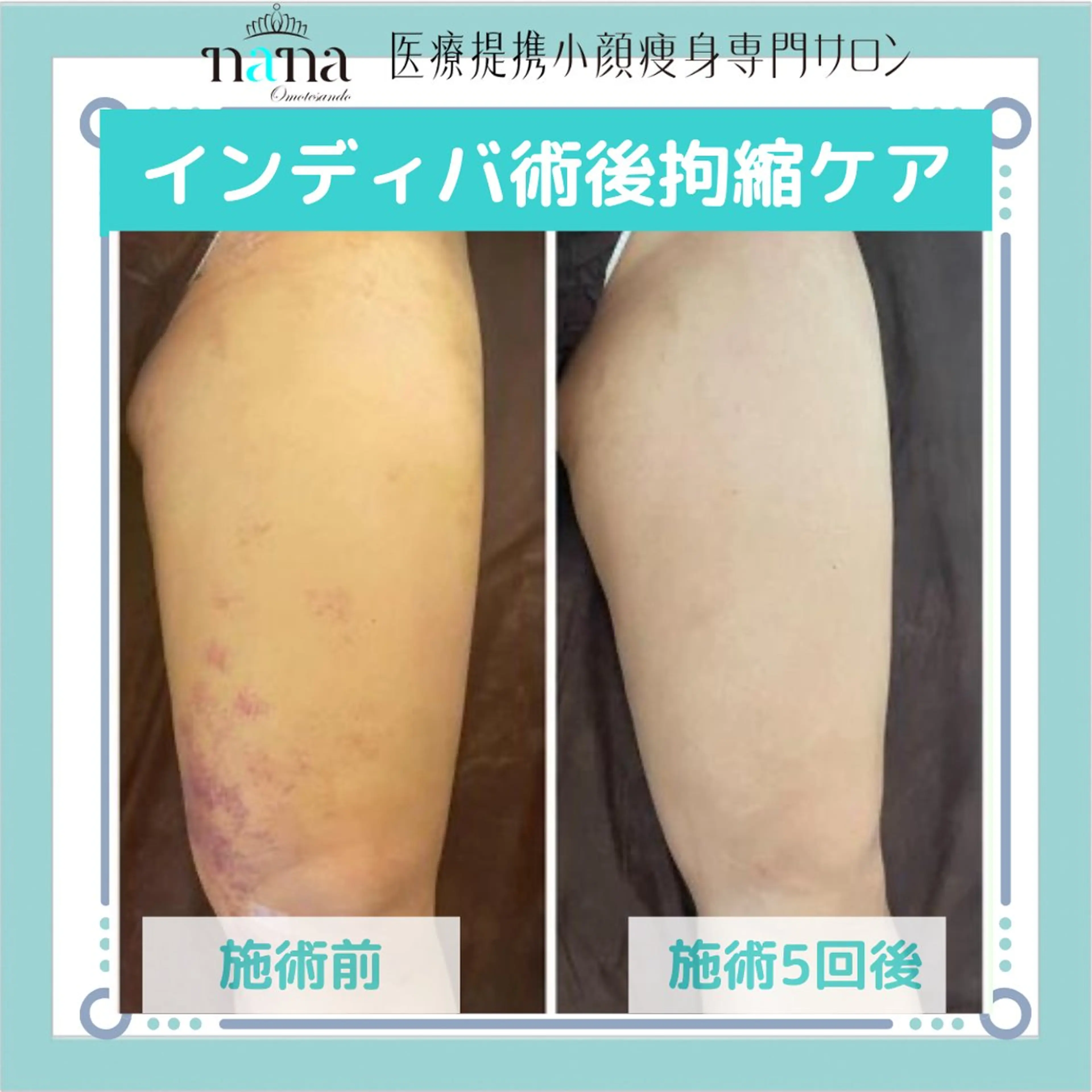 エステ リラク 小顔痩身インディバ Nana表参道のエステ・リラクイメージ