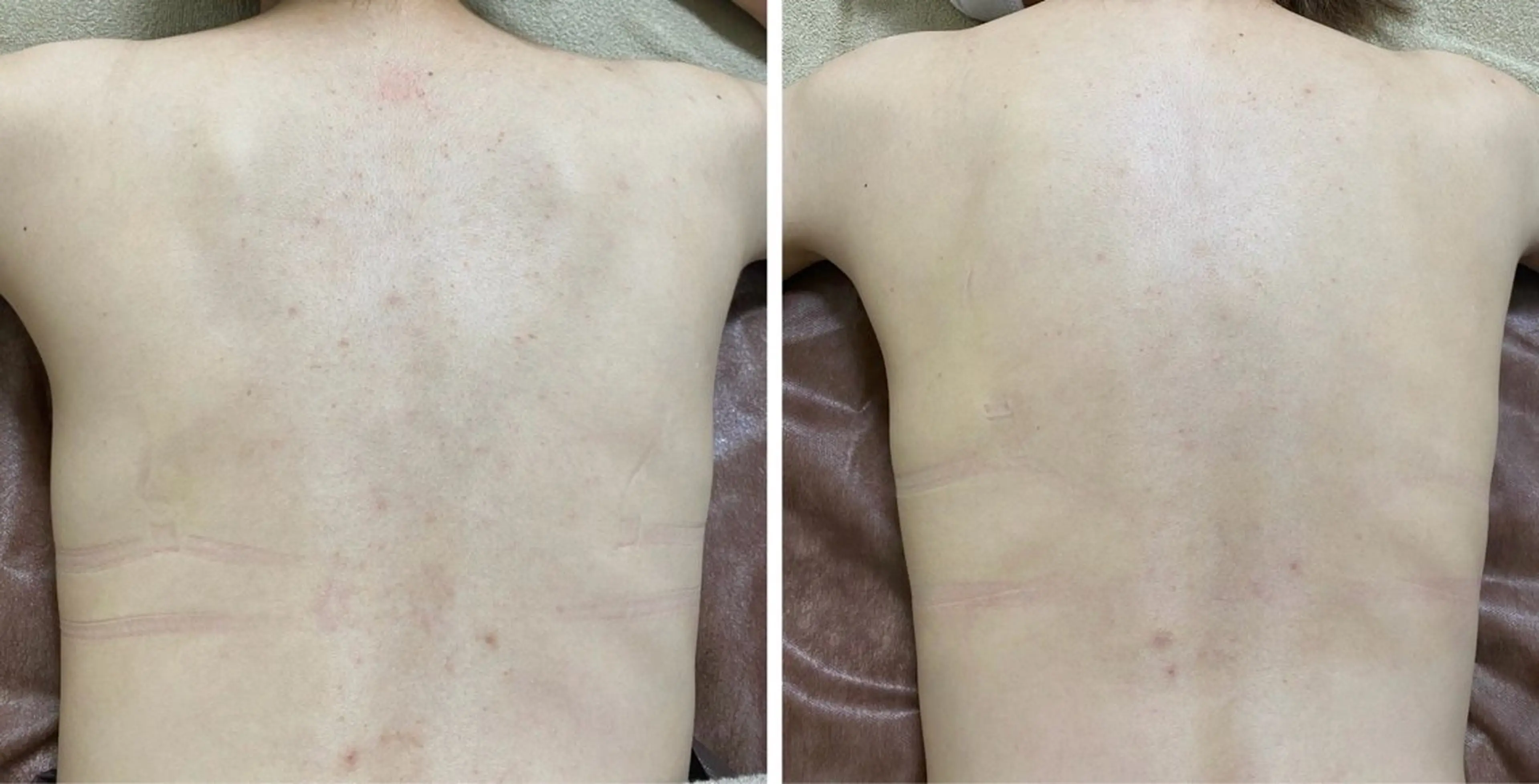 eto.所属・肌質改善サロン eto.のエステ・リラクイメージ