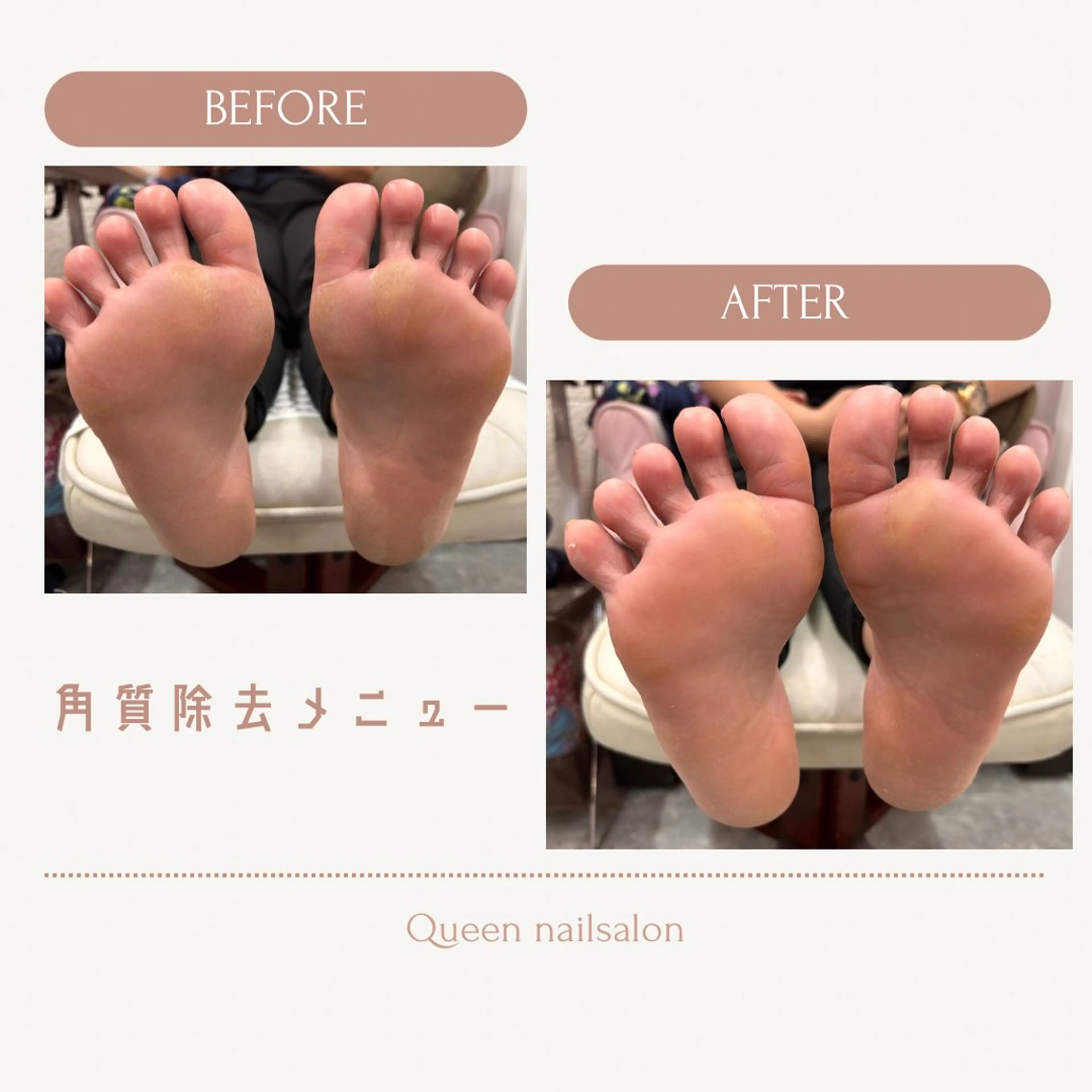 ネイル フットネイル ネイルサロンクイーン 東京/新宿/大久保のネイルデザイン