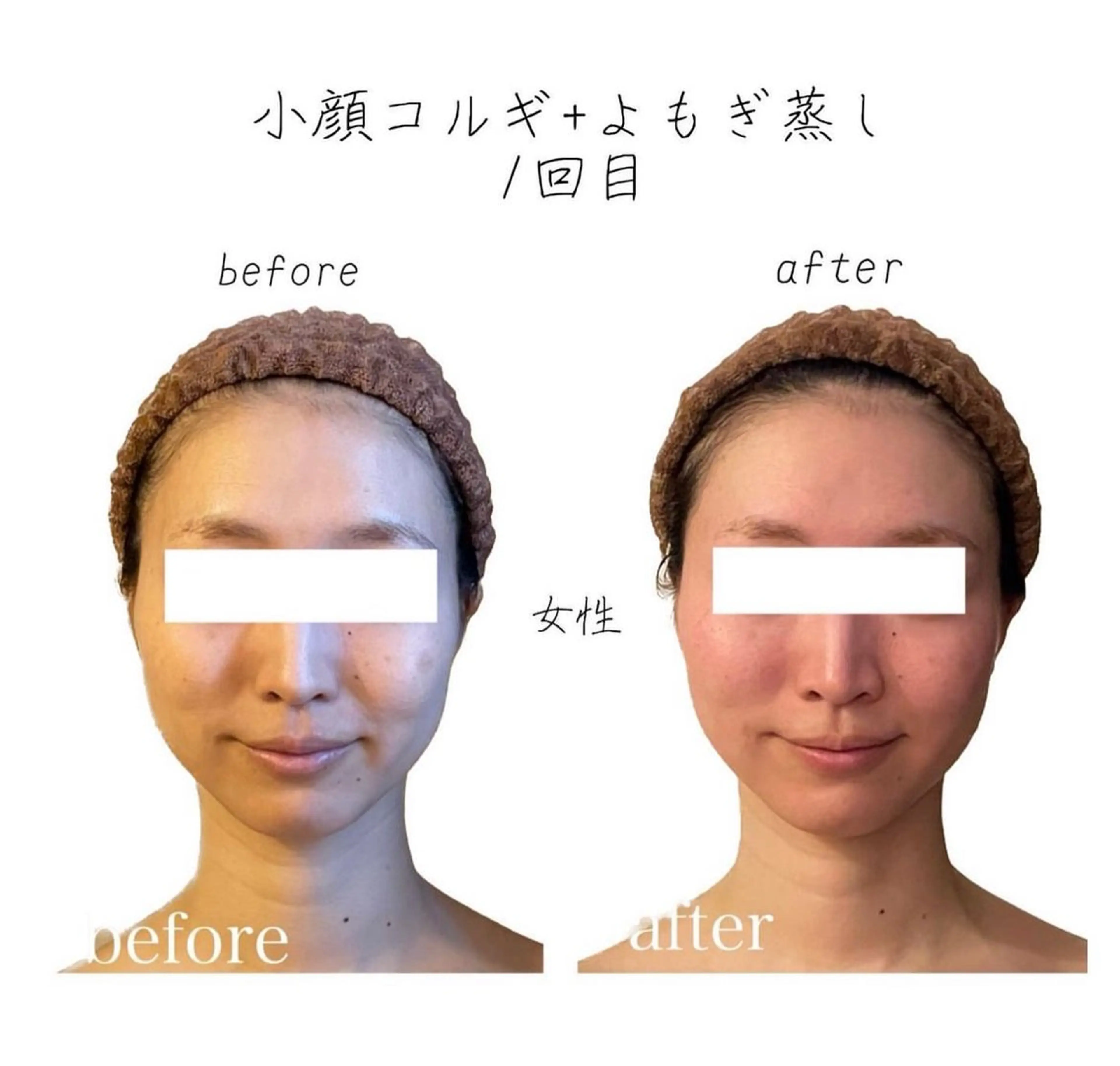 小顔コルギ専門店/隠れ家サロン《여름ヨルム》所属・小顔コルギ専門店 《ヨルム》龍ケ崎店のエステ・リラクイメージ