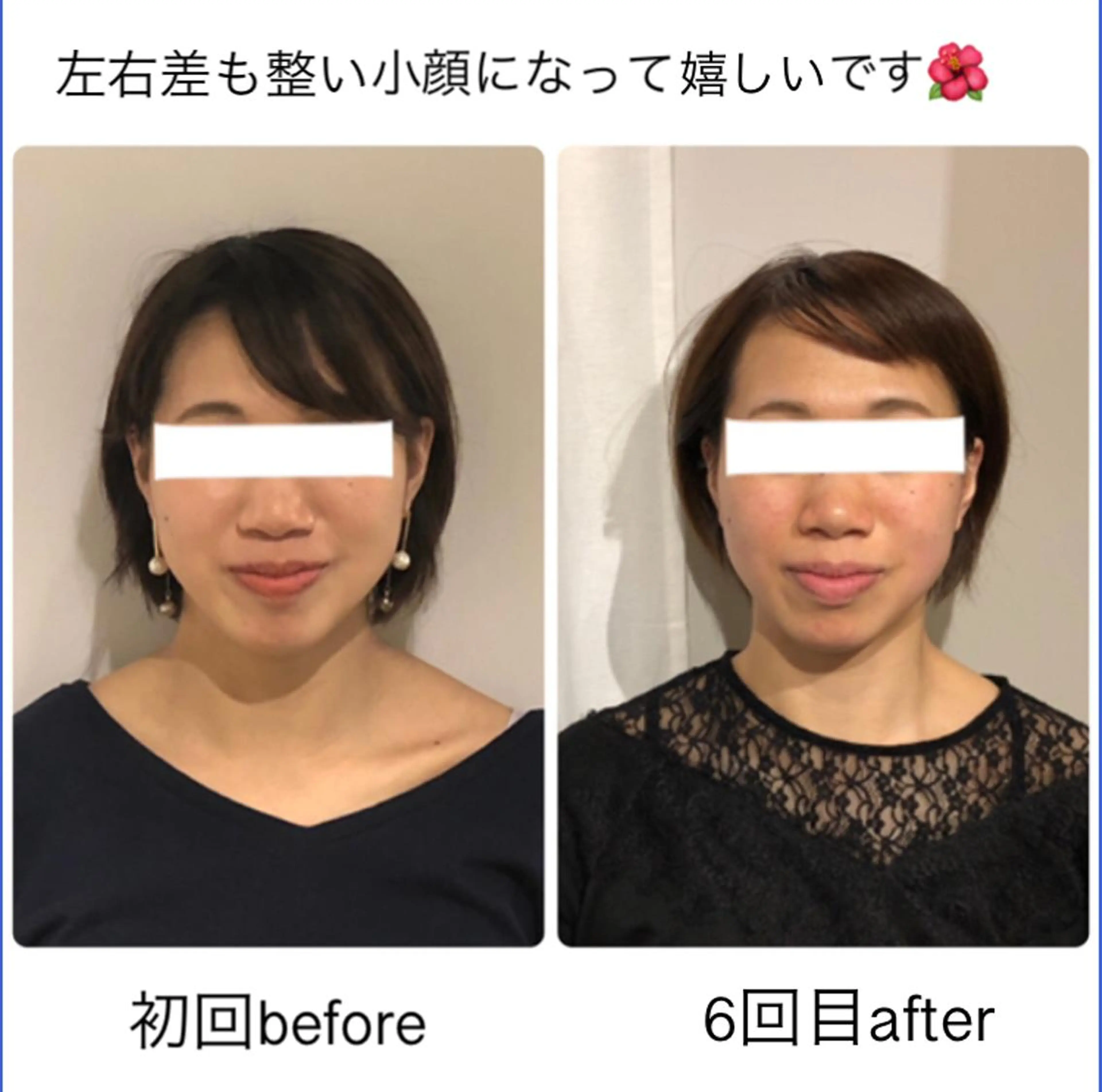 ショート カラー 小顔カット 小顔矯正専門サロンジュマリ所属・町田 淳子のエステ・リラクイメージ
