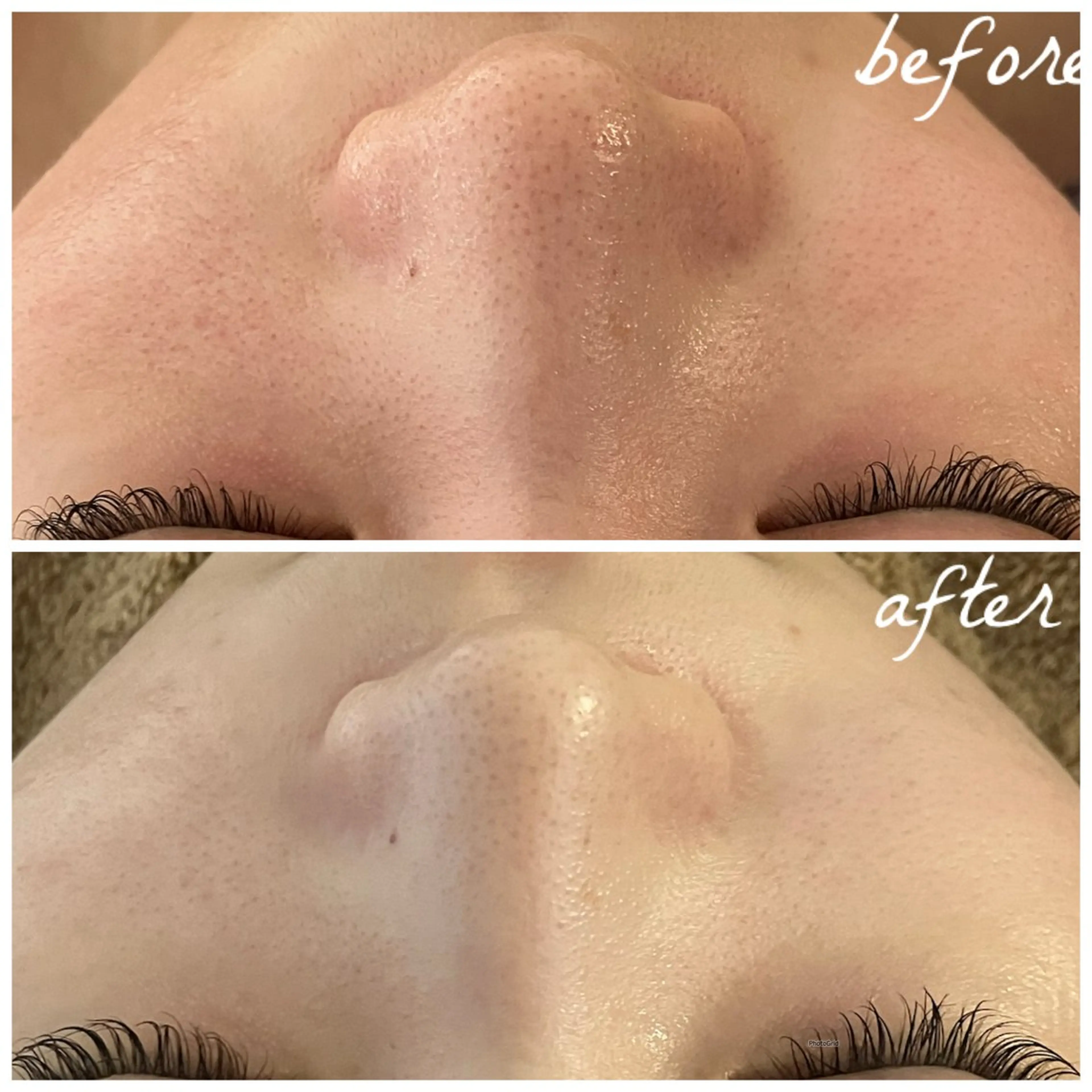 メンズ エステ メナード岐阜茜部 杉浦のエステ・リラクイメージ