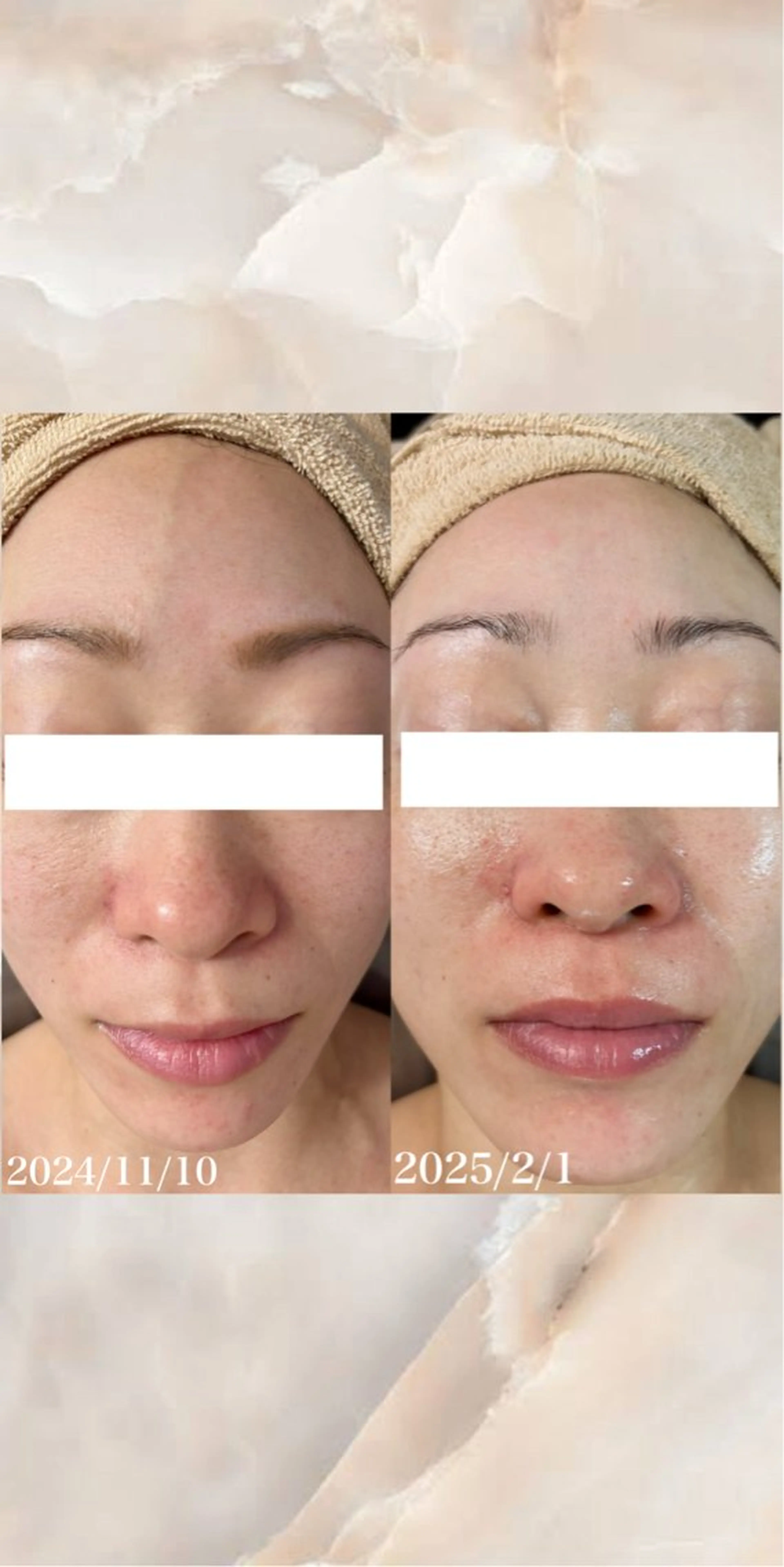 エステ WHITE AQUA 北千住店のエステ・リラクイメージ